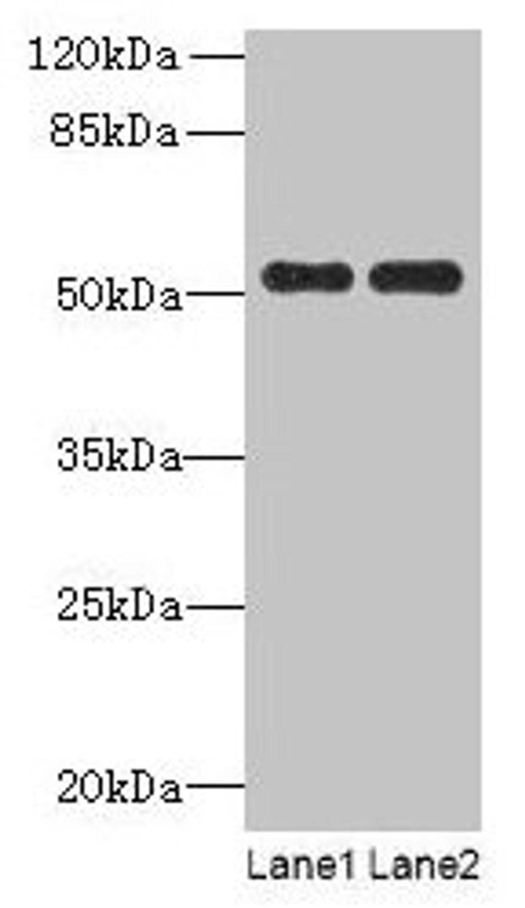 Western blot. All lanes: PAH antibody at 2.5µg/ml. Lane 1: Mouse kidney tissue. Lane 2: Mouse liver tissue. Secondary. Goat polyclonal to rabbit IgG at 1/10000 dilution. Predicted band size: 52 kDa. Observed band size: 52 kDa