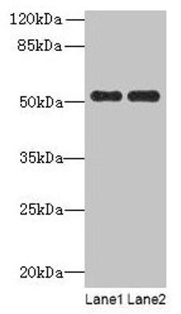 Western blot. All lanes: PAH antibody at 2.5µg/ml. Lane 1: Mouse kidney tissue. Lane 2: Mouse liver tissue. Secondary. Goat polyclonal to rabbit IgG at 1/10000 dilution. Predicted band size: 52 kDa. Observed band size: 52 kDa
