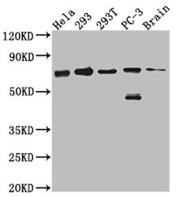 Western Blot. Positive WB detected in: Hela whole cell lysate, 293 whole cell lysate, 293T whole cell lysate, PC-3 whole cell lysate, Mouse Brain whole cell lysate. All lanes: LTA4H antibody at 1:1000. Secondary. Goat polyclonal to rabbit IgG at 1/50000 dilution. Predicted band size: 70, 60, 58, 67 kDa. Observed band size: 70 kDa. 