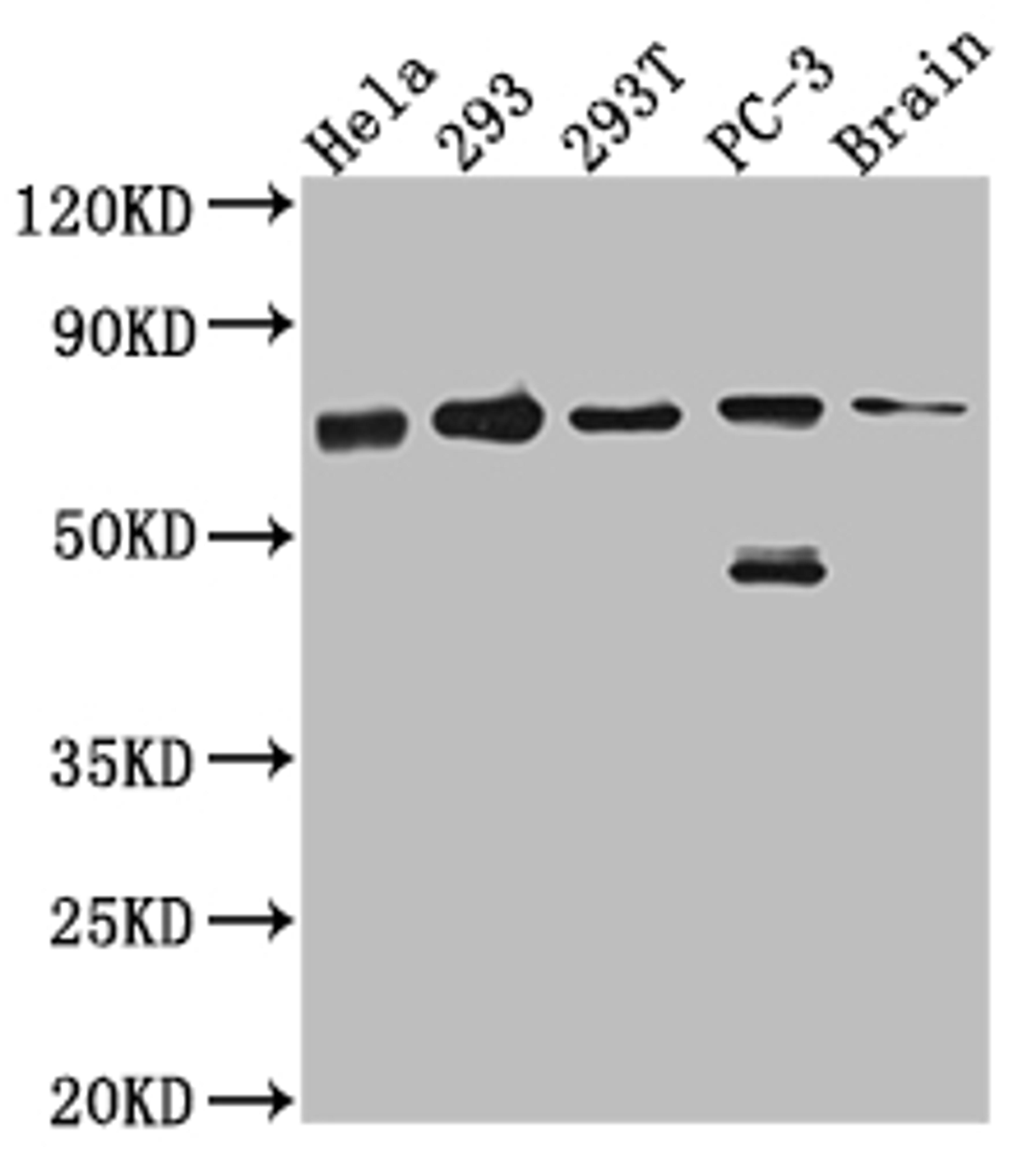 Western Blot. Positive WB detected in: Hela whole cell lysate, 293 whole cell lysate, 293T whole cell lysate, PC-3 whole cell lysate, Mouse Brain whole cell lysate. All lanes: LTA4H antibody at 1:1000. Secondary. Goat polyclonal to rabbit IgG at 1/50000 dilution. Predicted band size: 70, 60, 58, 67 kDa. Observed band size: 70 kDa. 