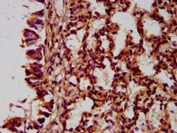 IHC image of CSB-PA771457LA01HU diluted at 1:400 and staining in paraffin-embedded human lung tissue performed on a Leica BondTM system. After dewaxing and hydration, antigen retrieval was mediated by high pressure in a citrate buffer (pH 6.0). Section was blocked with 10% normal goat serum 30min at RT. Then primary antibody (1% BSA) was incubated at 4&deg;C overnight. The primary is detected by a biotinylated secondary antibody and visualized using an HRP conjugated SP system.