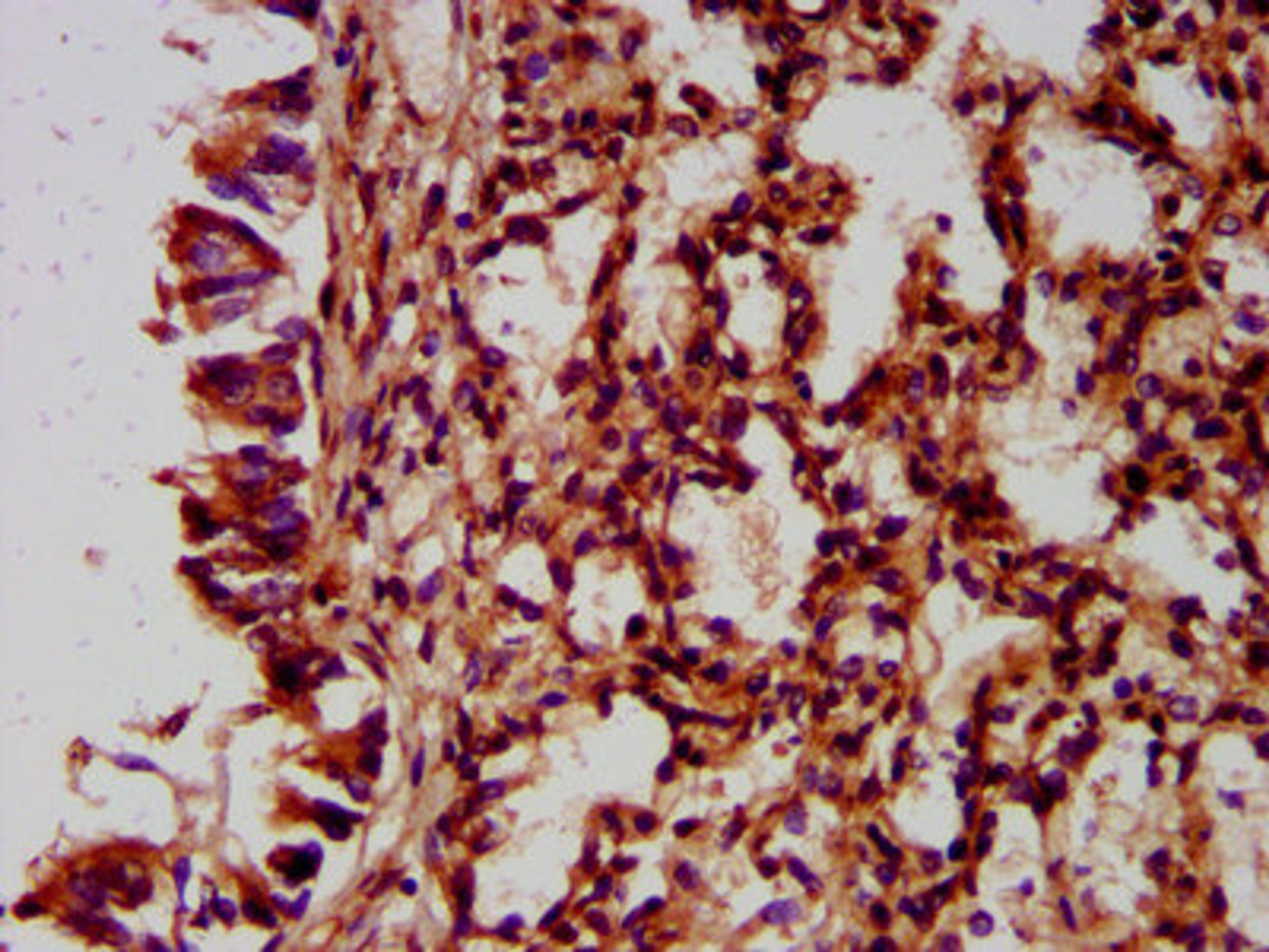 IHC image of CSB-PA771457LA01HU diluted at 1:400 and staining in paraffin-embedded human lung tissue performed on a Leica BondTM system. After dewaxing and hydration, antigen retrieval was mediated by high pressure in a citrate buffer (pH 6.0). Section was blocked with 10% normal goat serum 30min at RT. Then primary antibody (1% BSA) was incubated at 4&deg;C overnight. The primary is detected by a biotinylated secondary antibody and visualized using an HRP conjugated SP system.