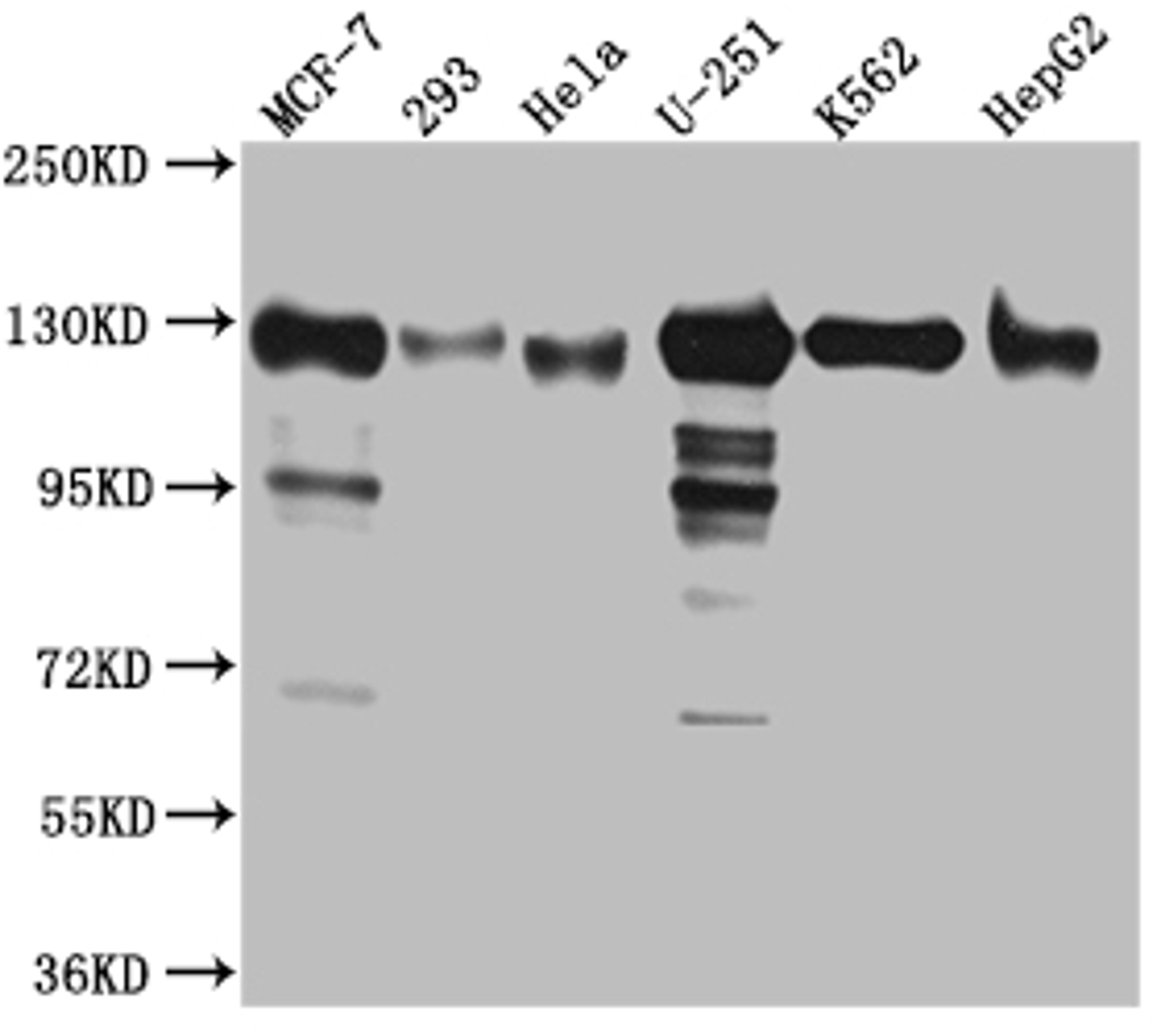Western Blot. Positive WB detected in: MCF-7 whole cell lysate, 293 whole cell lysate, Hela whole cell lysate, U-251 whole cell lysate, K562 whole cell lysate, HepG2 whole cell lysat. All lanes: Eg5 Antibody at 1:1000. Secondary. Goat polyclonal to rabbit IgG at 1/50000 dilution. Predicted band size: 120 kDa. Observed band size: 130 kDa. 
