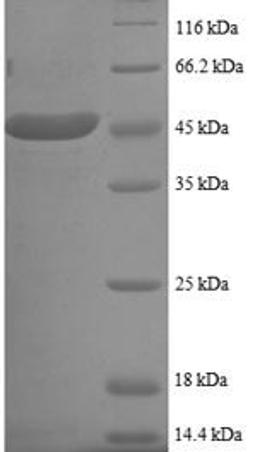(Tris-Glycine gel) Discontinuous SDS-PAGE (reduced) with 5% enrichment gel and 15% separation gel.