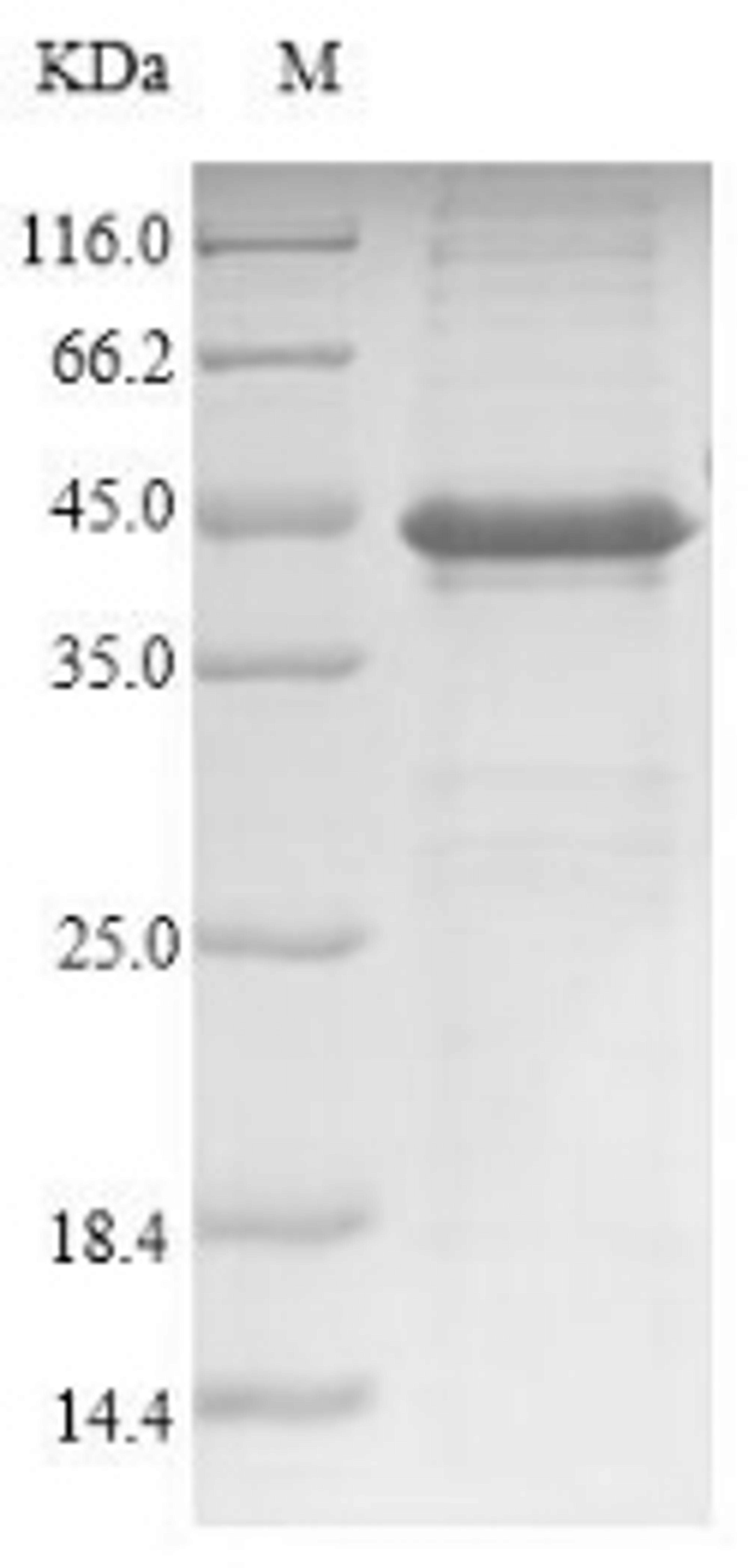 (Tris-Glycine gel) Discontinuous SDS-PAGE (reduced) with 5% enrichment gel and 15% separation gel.