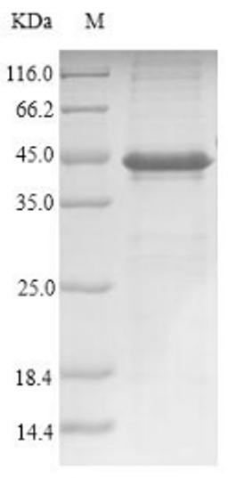 (Tris-Glycine gel) Discontinuous SDS-PAGE (reduced) with 5% enrichment gel and 15% separation gel.