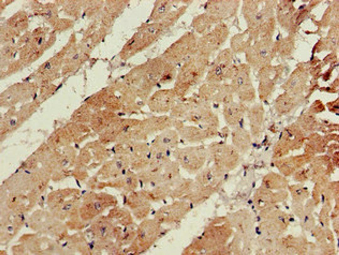 Immunohistochemistry of paraffin-embedded human heart tissue using CSB-PA002550LA01HU at dilution of 1:100