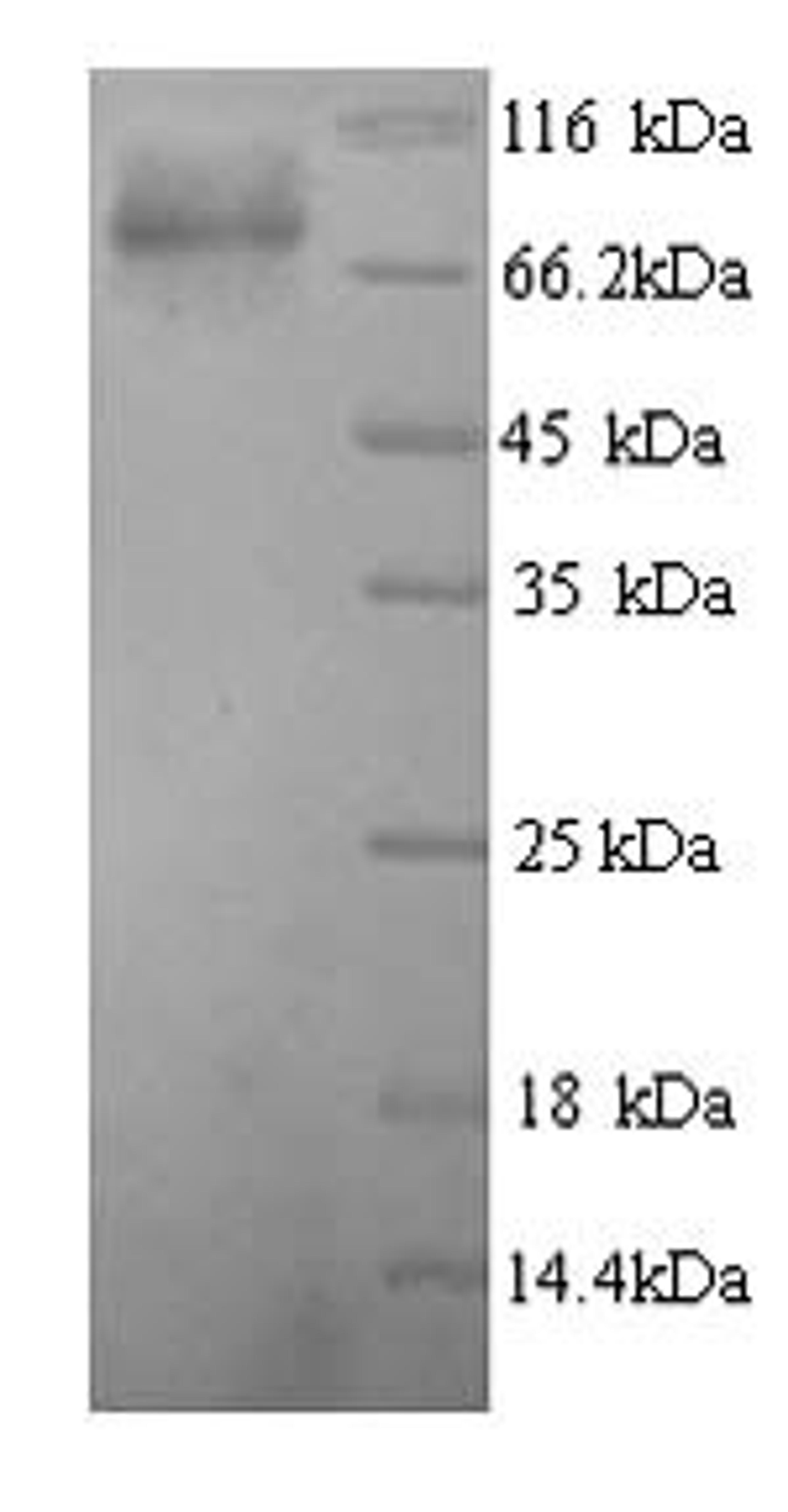 (Tris-Glycine gel) Discontinuous SDS-PAGE (reduced) with 5% enrichment gel and 15% separation gel.