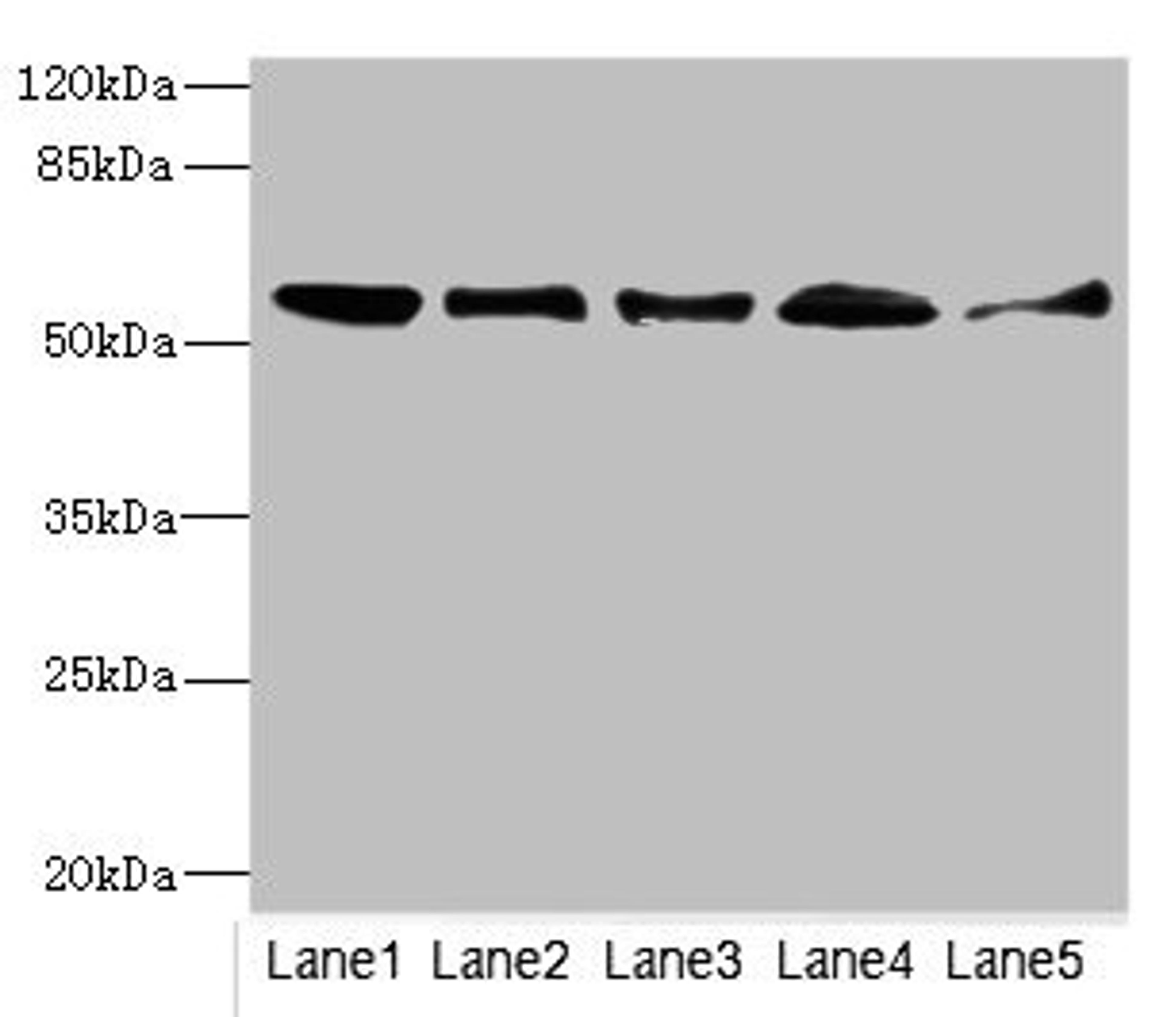 Western blot. All lanes: GLYCTKantibody at 5.43ug/ml. Lane 1: Mouse liver tissue. Lane 2: Mouse lung tissue. Lane 3: Mouse kidney tissue. Lane 4: Rat lung tissue. Lane 5: NIH/3T3 whole cell lysate. Secondary. Goat polyclonal to rabbit IgG at 1/10000 dilution. Predicted band size: 56, 26, 49, 39, 20, 23 kDa. Observed band size: 56 kDa. 