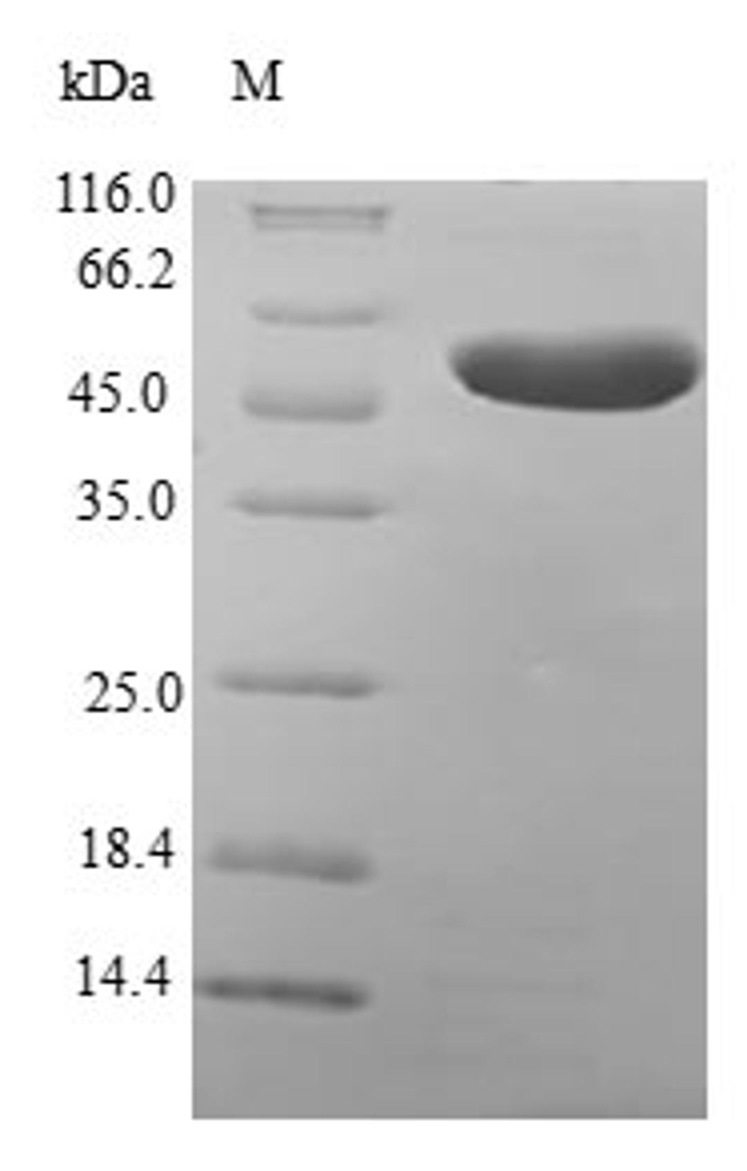 (Tris-Glycine gel) Discontinuous SDS-PAGE (reduced) with 5% enrichment gel and 15% separation gel.