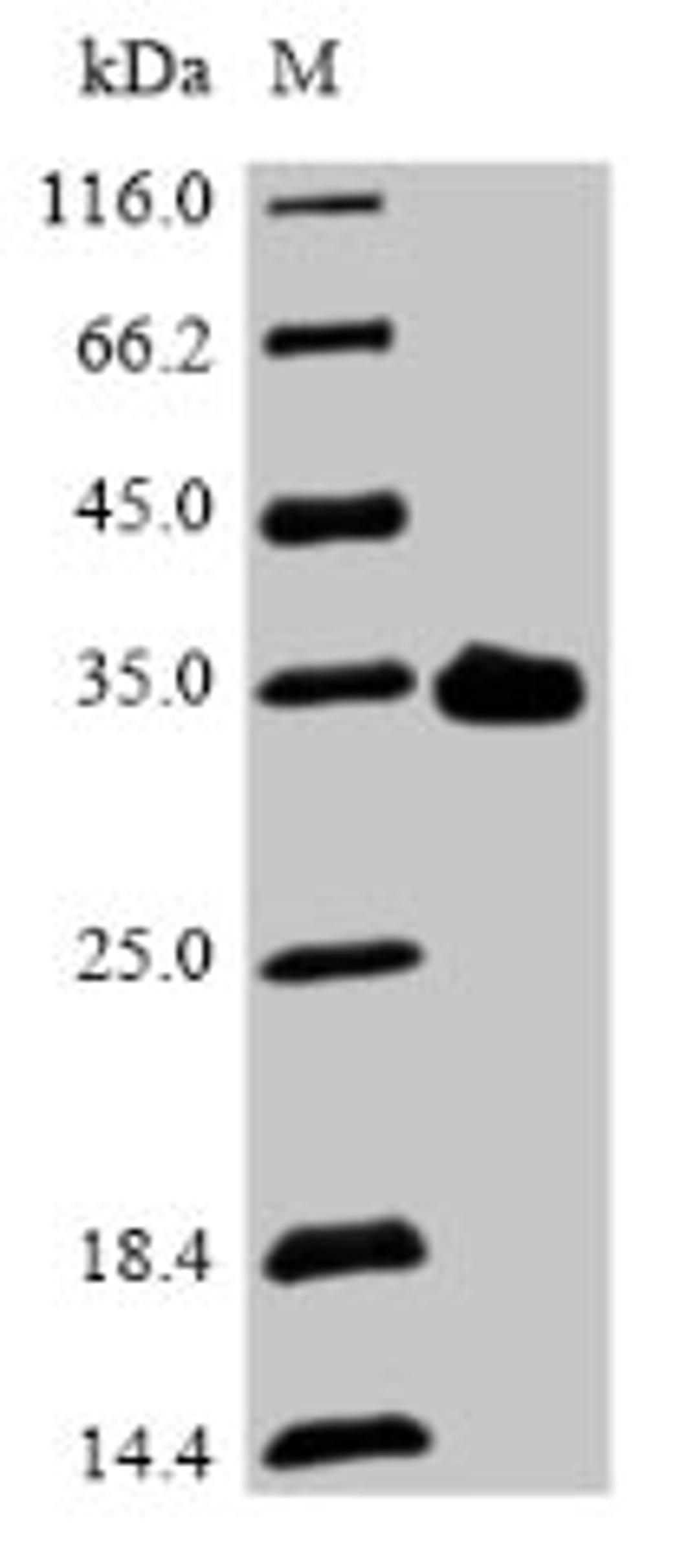 (Tris-Glycine gel) Discontinuous SDS-PAGE (reduced) with 5% enrichment gel and 15% separation gel.