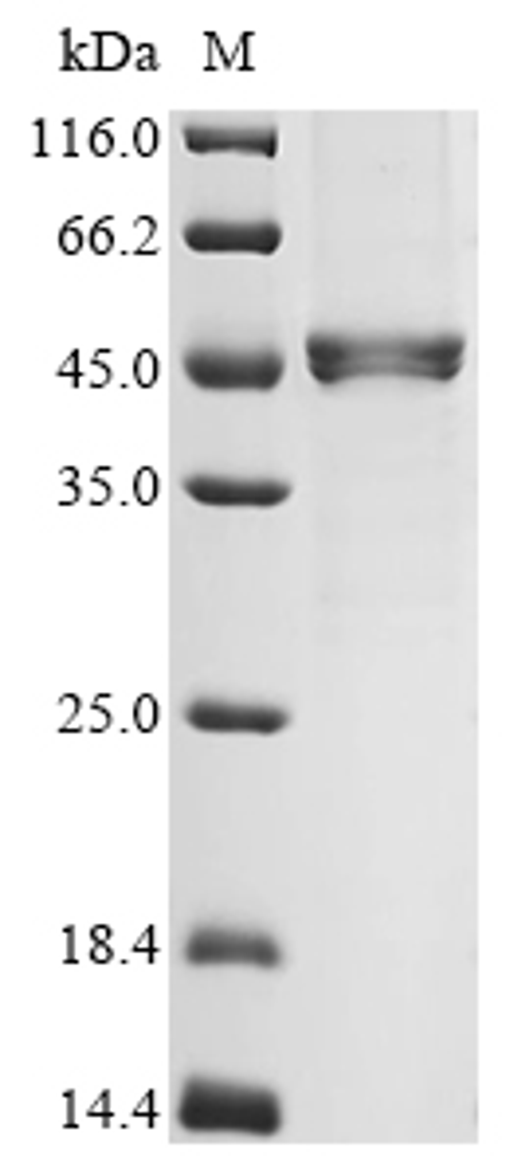 (Tris-Glycine gel) Discontinuous SDS-PAGE (reduced) with 5% enrichment gel and 15% separation gel.