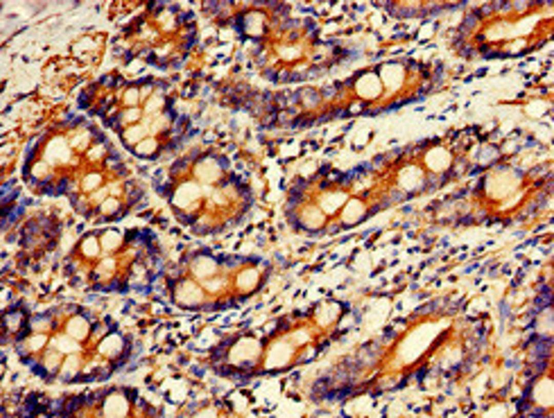 Immunohistochemistry of paraffin-embedded human small intestine tissue using CSB-PA009703LA01HU at dilution of 1:100