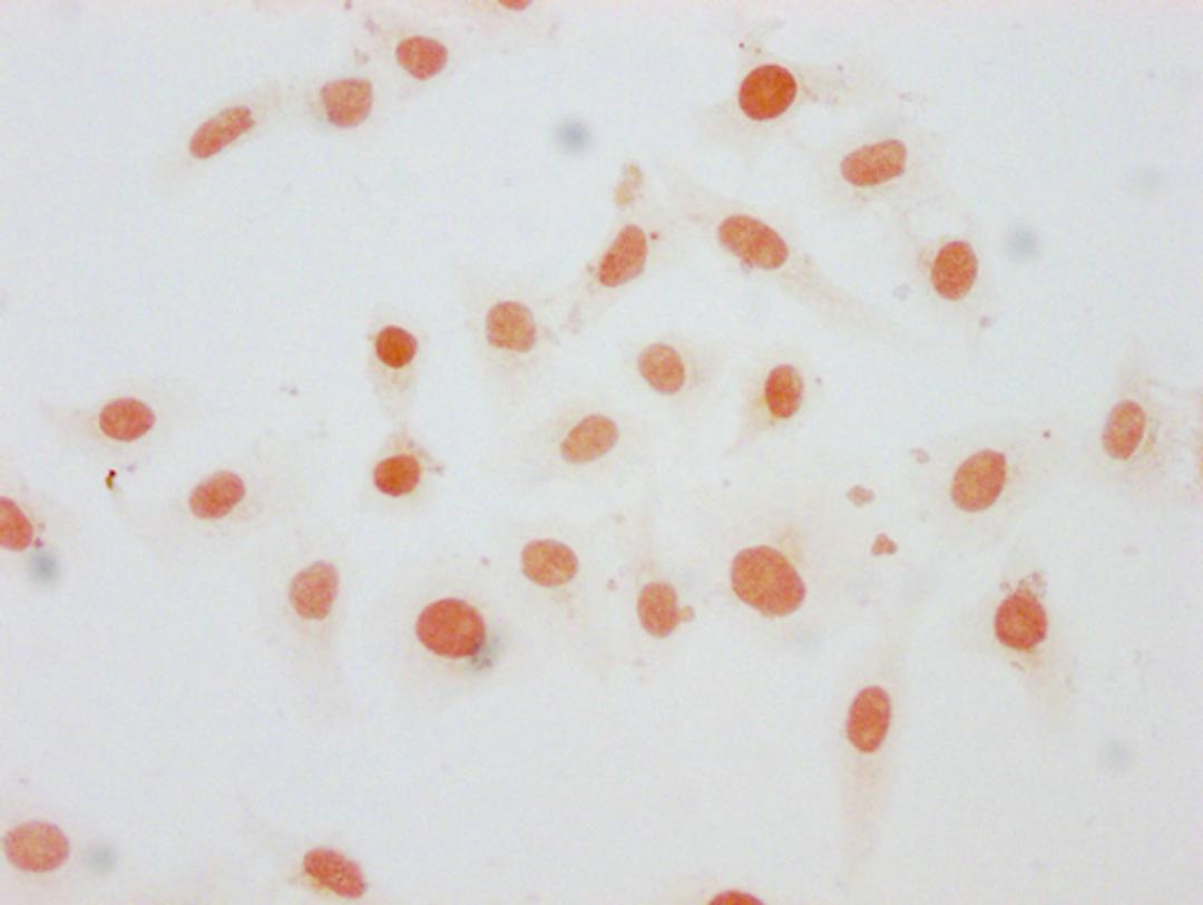 Immunocytochemistry analysis of CSB-PA010376OA21me1HU diluted at 1:20 and staining in Hela cells performed on a Leica BondTM system. The cells were fixed in 4% formaldehyde, permeabilized using 0.2% Triton X-100 and blocked with 10% normal goat serum 30min at RT. Then primary antibody (1% BSA) was incubated at 4°C overnight. The primary is detected by a biotinylated secondary antibody and visualized using an HRP conjugated SP system.