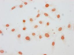 Immunocytochemistry analysis of CSB-PA010376OA21me1HU diluted at 1:20 and staining in Hela cells performed on a Leica BondTM system. The cells were fixed in 4% formaldehyde, permeabilized using 0.2% Triton X-100 and blocked with 10% normal goat serum 30min at RT. Then primary antibody (1% BSA) was incubated at 4°C overnight. The primary is detected by a biotinylated secondary antibody and visualized using an HRP conjugated SP system.
