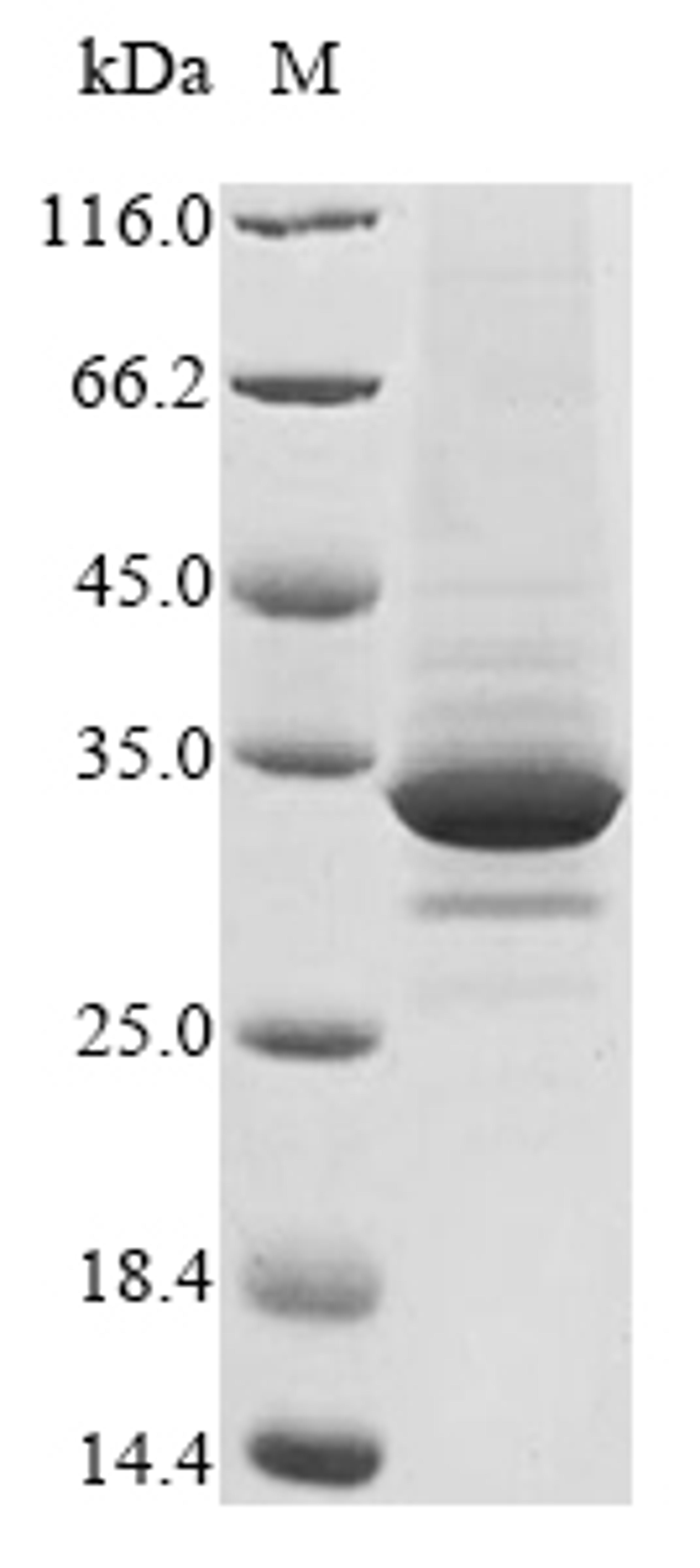 (Tris-Glycine gel) Discontinuous SDS-PAGE (reduced) with 5% enrichment gel and 15% separation gel.