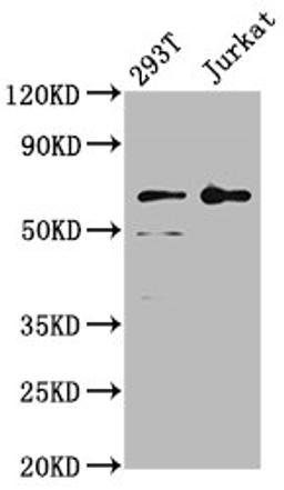Western Blot. Positive WB detected in: 293T whole cell lysate, Jurkat whole cell lysate. All lanes: LILRB2 antibody at 4µg/ml. Secondary. Goat polyclonal to rabbit IgG at 1/50000 dilution. Predicted band size: 66, 65, 56, 52 kDa. Observed band size: 66 kDa