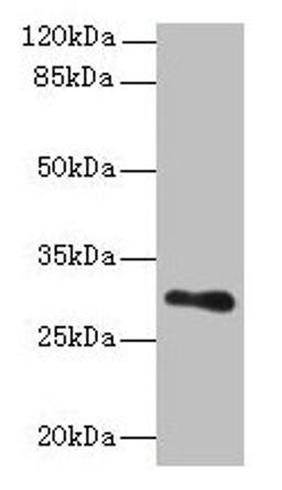Western blot. All lanes: TMEM176B antibody at 8µg/ml + Human placenta tissue. Secondary. Goat polyclonal to rabbit IgG at 1/10000 dilution. Predicted band size: 30, 26 kDa. Observed band size: 30 kDa