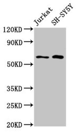 Western Blot. Positive WB detected in: Jurkat whole cell lysate, SH-SY5Y whole cell lysate. All lanes: BORA antibody at 4.8µg/ml. Secondary. Goat polyclonal to rabbit IgG at 1/50000 dilution. Predicted band size: 62, 54 kDa. Observed band size: 62 kDa