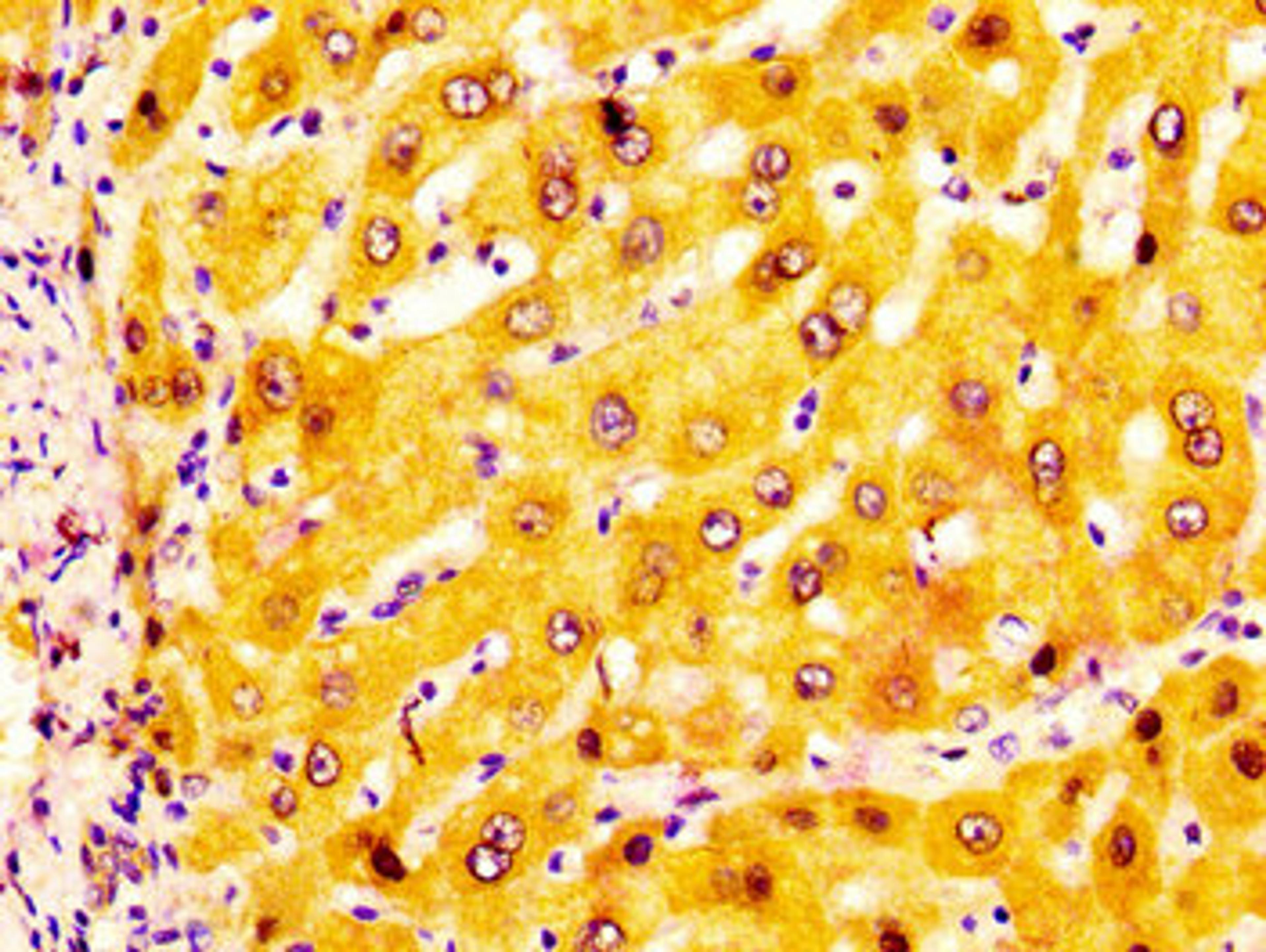 IHC image of CSB-PA001353LA01HU diluted at 1:200 and staining in paraffin-embedded human liver tissue performed on a Leica BondTM system. After dewaxing and hydration, antigen retrieval was mediated by high pressure in a citrate buffer (pH 6.0). Section was blocked with 10% normal goat serum 30min at RT. Then primary antibody (1% BSA) was incubated at 4&deg;C overnight. The primary is detected by a biotinylated secondary antibody and visualized using an HRP conjugated SP system.