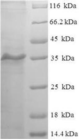 (Tris-Glycine gel) Discontinuous SDS-PAGE (reduced) with 5% enrichment gel and 15% separation gel.