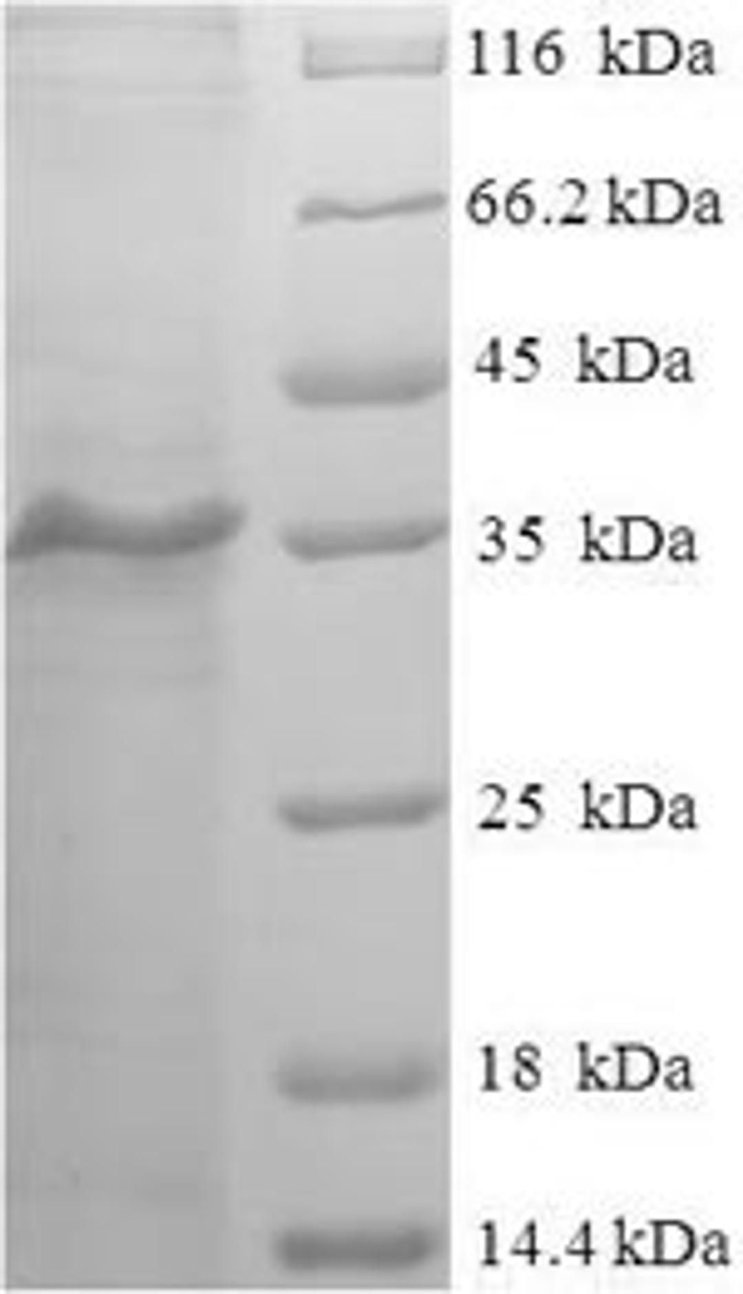 (Tris-Glycine gel) Discontinuous SDS-PAGE (reduced) with 5% enrichment gel and 15% separation gel.