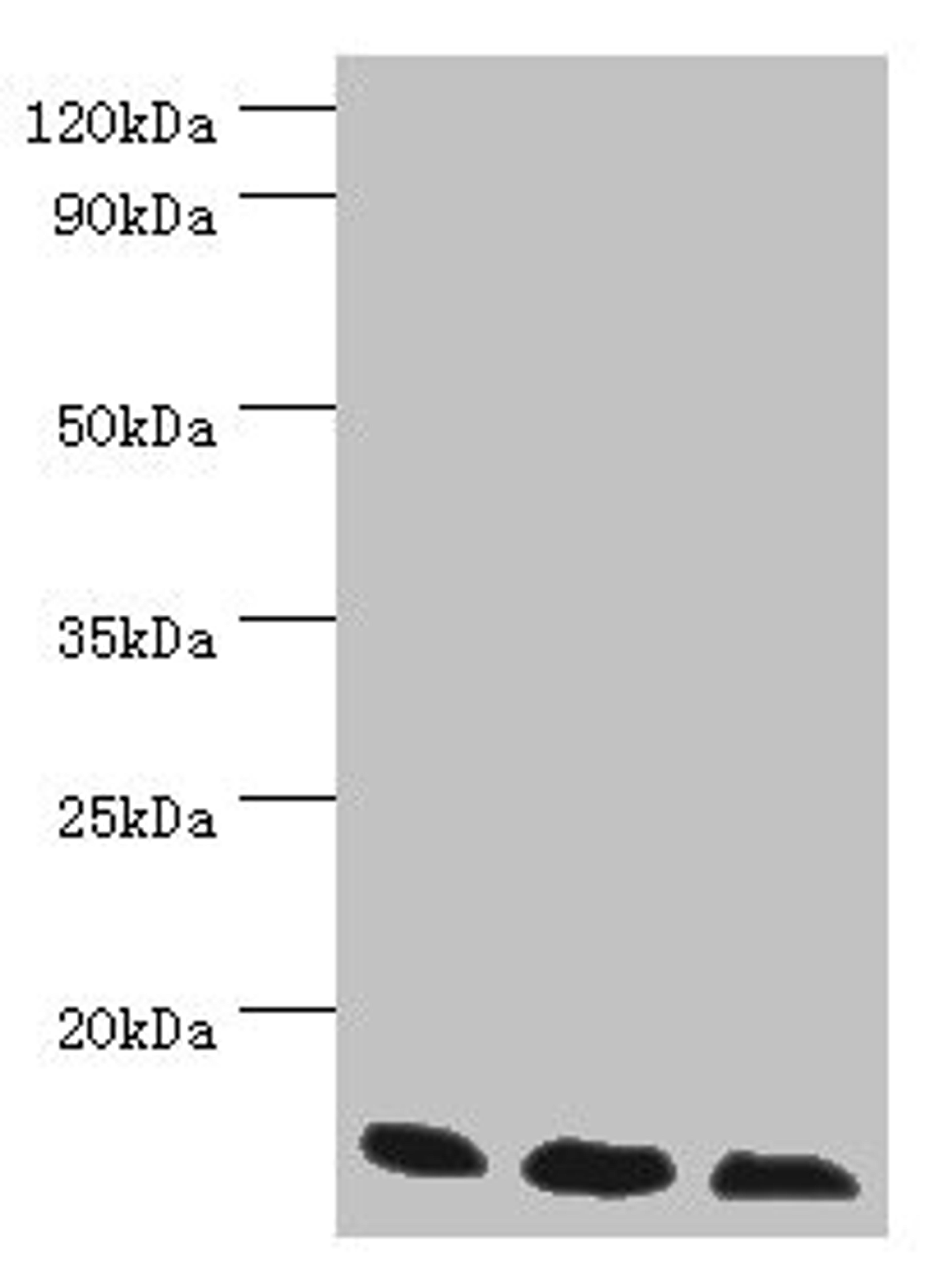 Western blot. All lanes: Transcription elongation factor B polypeptide 2 antibody at 3ug/ml. Lane 1: k562 whole cell lysate. Lane 2: 293T whole cell lysate. Lane 3: HL60 whole cell lysate. Secondary. Goat polyclonal to rabbit IgG at 1/10000 dilution. Predicted band size: 14, 18 kDa. Observed band size: 14 kDa. 