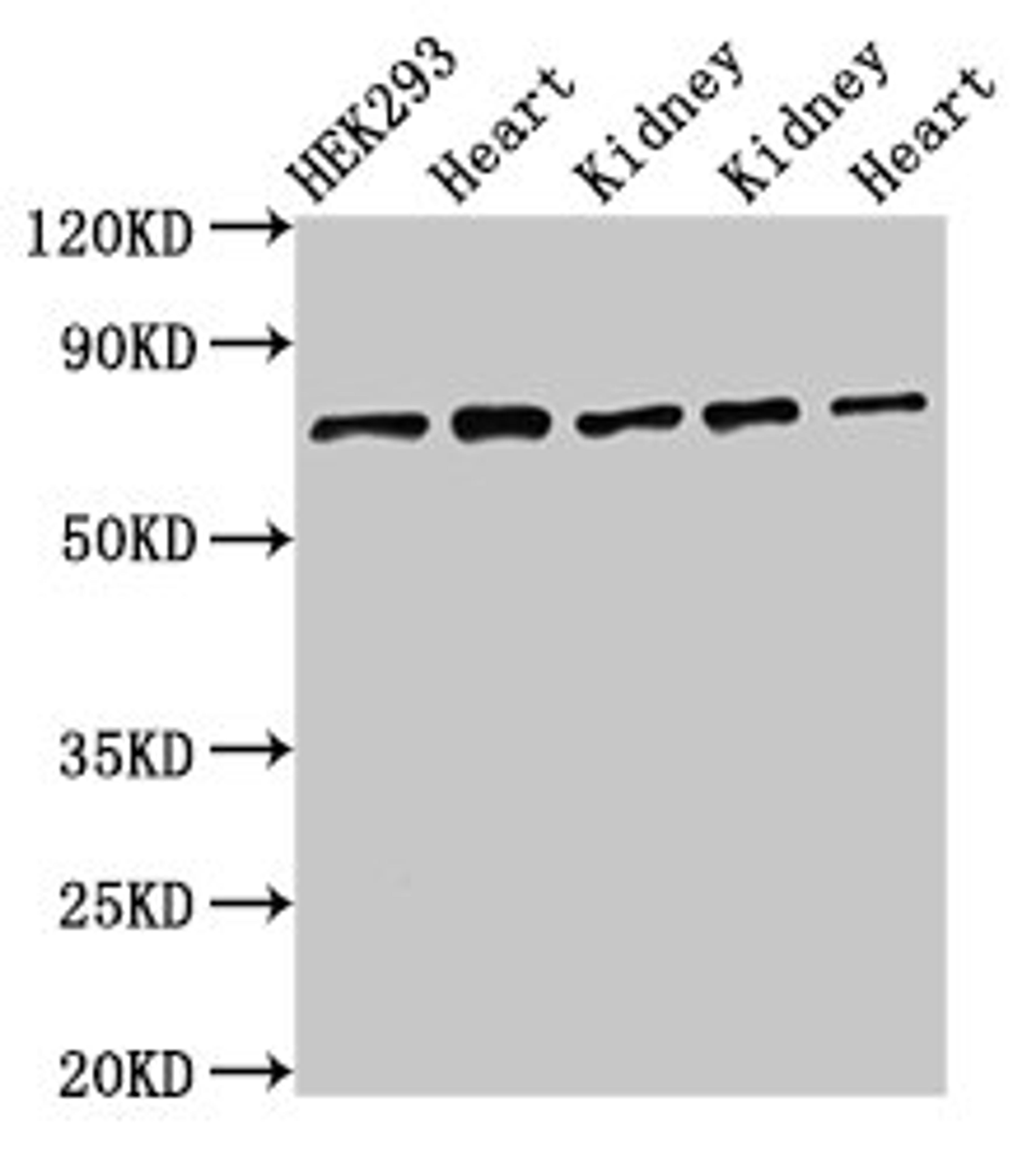 Western Blot. Positive WB detected in: HEK293 whole cell lysate, Rat heart tissue, Rat kidney tissue, Mouse kidney tissue, Mouse heart tissue. All lanes: SLC25A12 antibody at 3µg/ml. Secondary. Goat polyclonal to rabbit IgG at 1/50000 dilution. Predicted band size: 75, 63 kDa. Observed band size: 75 kDa