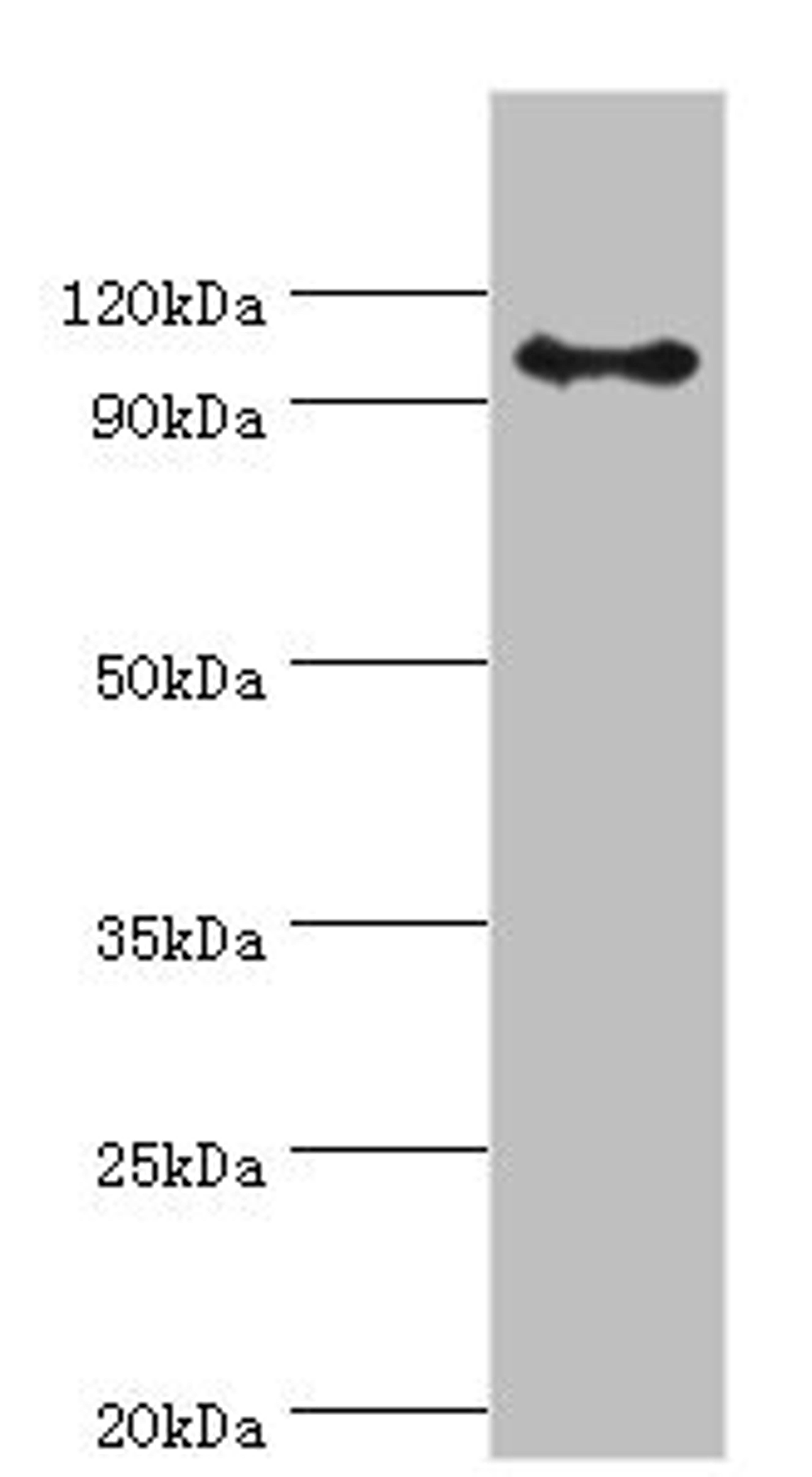 Western blot. All lanes: AP-2 complex subunit beta antibody at 8ug/ml + Mouse brain tissue. Secondary. Goat polyclonal to rabbit IgG at 1/10000 dilution. Predicted band size: 105, 106, 99 kDa. Observed band size: 105 kDa. 