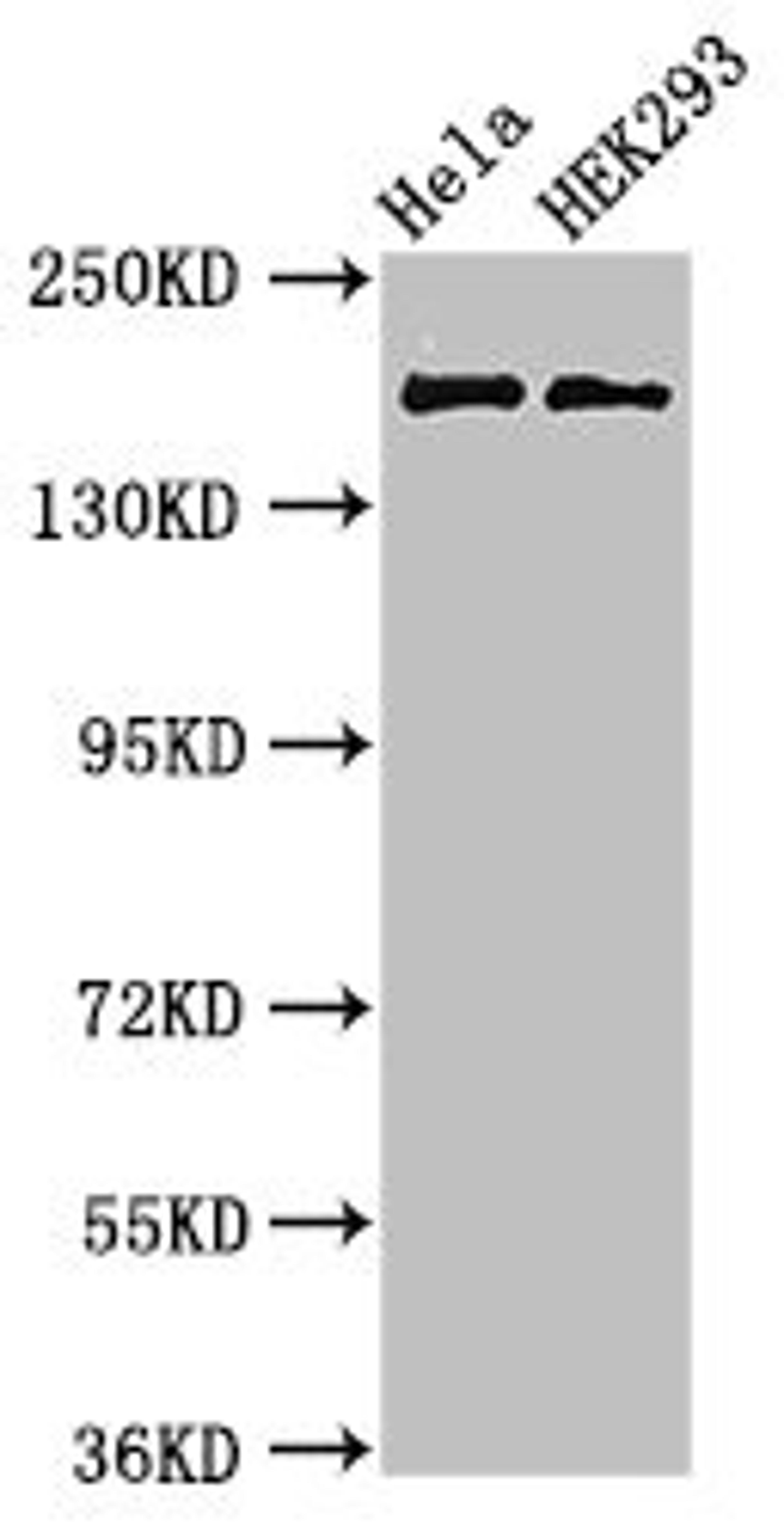 Western Blot. Positive WB detected in: Hela whole cell lysate, HEK293 whole cell lysate. All lanes: KIDINS220 antibody at 3µg/ml. Secondary. Goat polyclonal to rabbit IgG at 1/50000 dilution. Predicted band size: 197, 186, 116, 195, 60 kDa. Observed band size: 197 kDa
