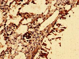 Immunohistochemistry of paraffin-embedded human lung tissue using CSB-PA021637LA01HU at dilution of 1:100