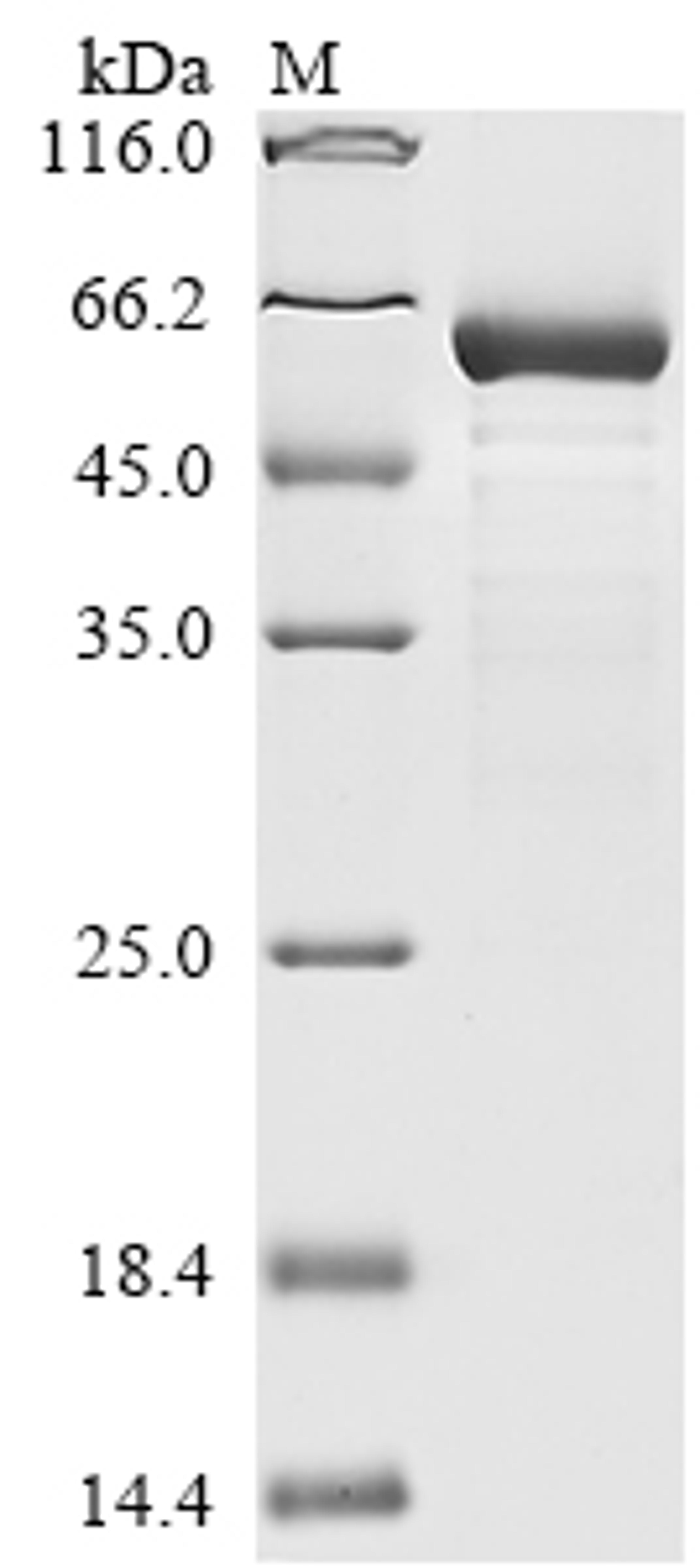 (Tris-Glycine gel) Discontinuous SDS-PAGE (reduced) with 5% enrichment gel and 15% separation gel.