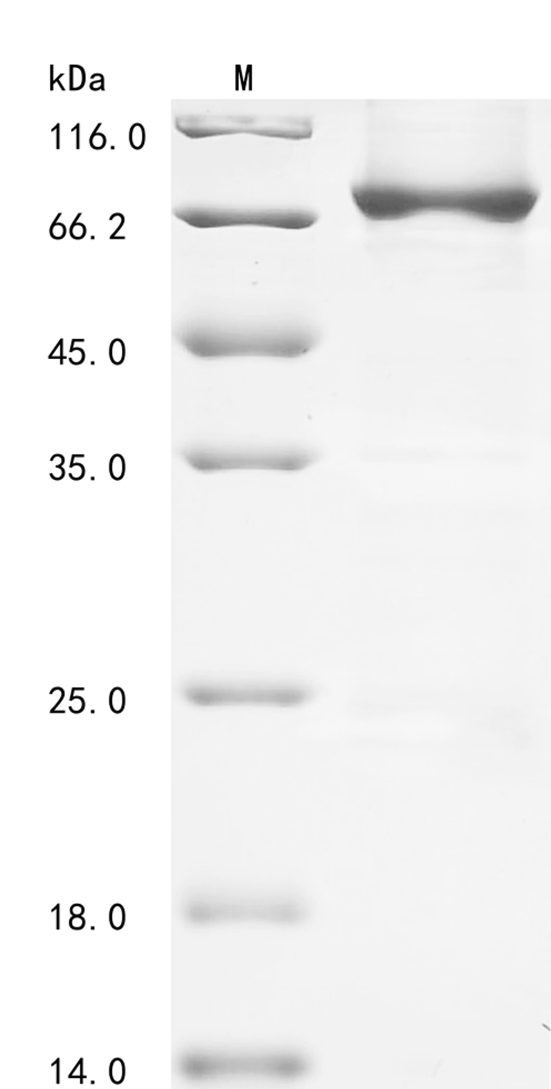 (Tris-Glycine gel) Discontinuous SDS-PAGE (reduced) with 5% enrichment gel and 15% separation gel.
