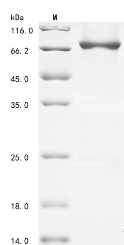 (Tris-Glycine gel) Discontinuous SDS-PAGE (reduced) with 5% enrichment gel and 15% separation gel.