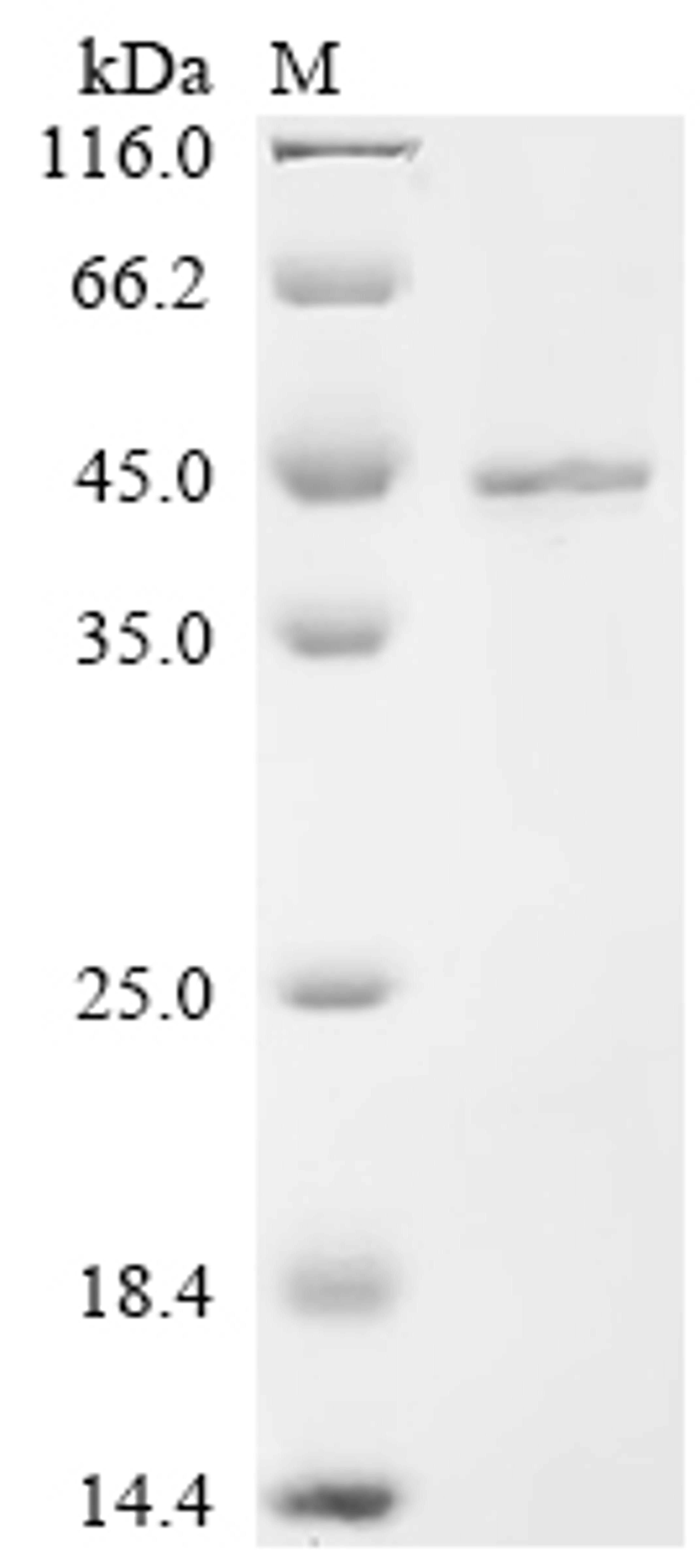 (Tris-Glycine gel) Discontinuous SDS-PAGE (reduced) with 5% enrichment gel and 15% separation gel.