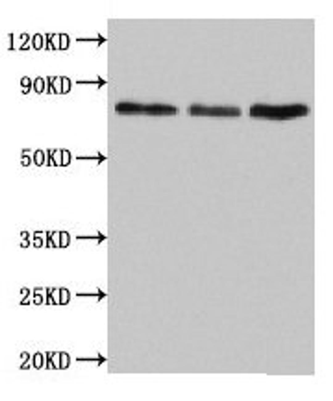 Western Blot. Positive WB detected in: Jurkat whole cell lysate, Rat lung tissue, Mouse liver tissue. All lanes: SUN2 antibody at 4.5µg/ml. Secondary. Goat polyclonal to rabbit IgG at 1/50000 dilution. Predicted band size: 81, 83, 80 kDa. Observed band size: 81 kDa