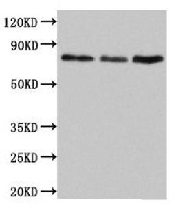 Western Blot. Positive WB detected in: Jurkat whole cell lysate, Rat lung tissue, Mouse liver tissue. All lanes: SUN2 antibody at 4.5µg/ml. Secondary. Goat polyclonal to rabbit IgG at 1/50000 dilution. Predicted band size: 81, 83, 80 kDa. Observed band size: 81 kDa