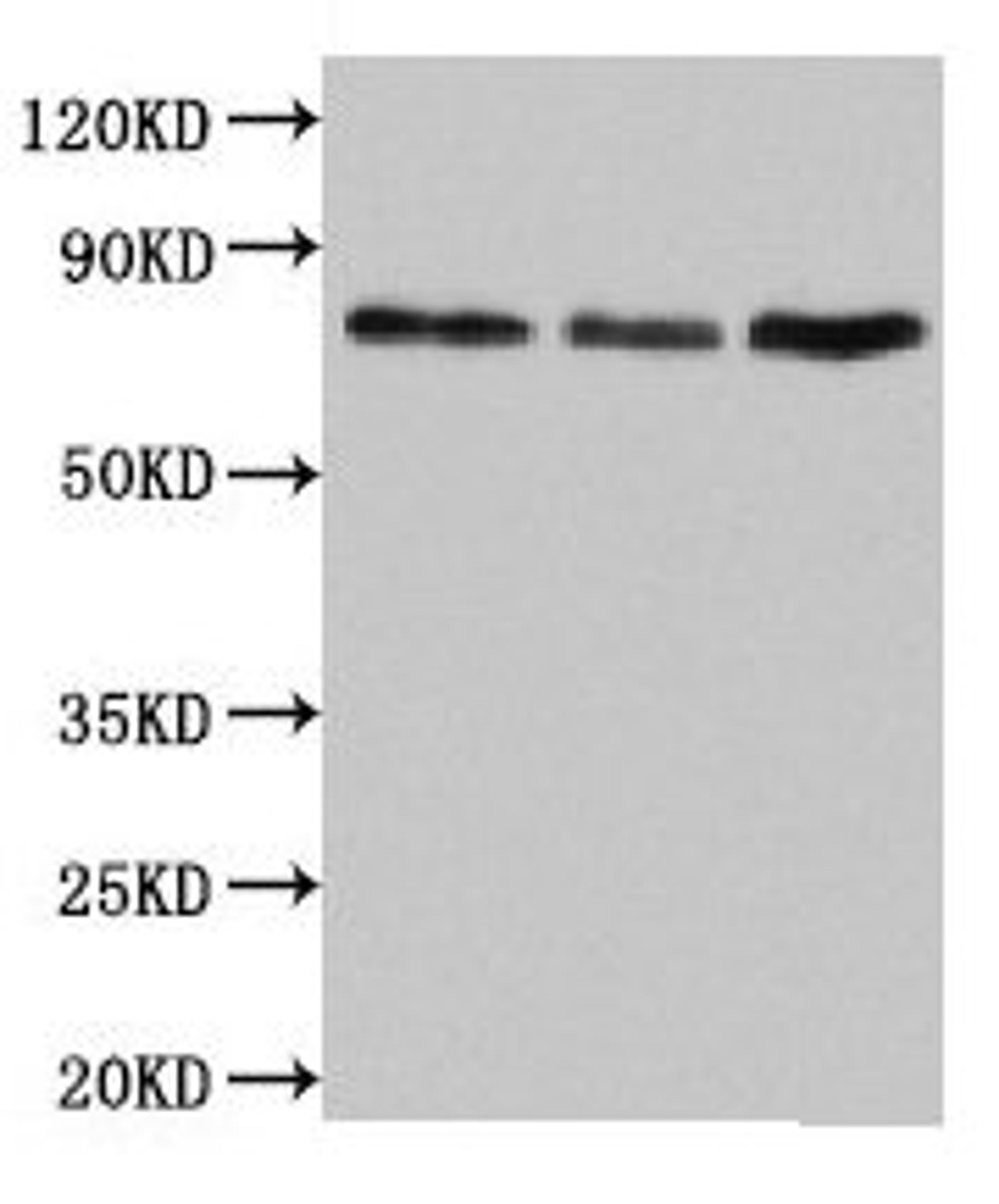 Western Blot. Positive WB detected in: Jurkat whole cell lysate, Rat lung tissue, Mouse liver tissue. All lanes: SUN2 antibody at 4.5µg/ml. Secondary. Goat polyclonal to rabbit IgG at 1/50000 dilution. Predicted band size: 81, 83, 80 kDa. Observed band size: 81 kDa