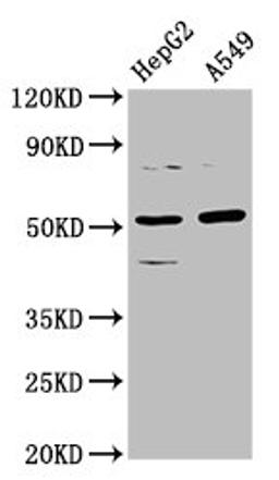 Western Blot. Positive WB detected in: HepG2 whole cell lysate, A549 whole cell lysate. All lanes: CPOX antibody at 5.7µg/ml. Secondary. Goat polyclonal to rabbit IgG at 1/50000 dilution. Predicted band size: 51, 31 kDa. Observed band size: 51 kDa