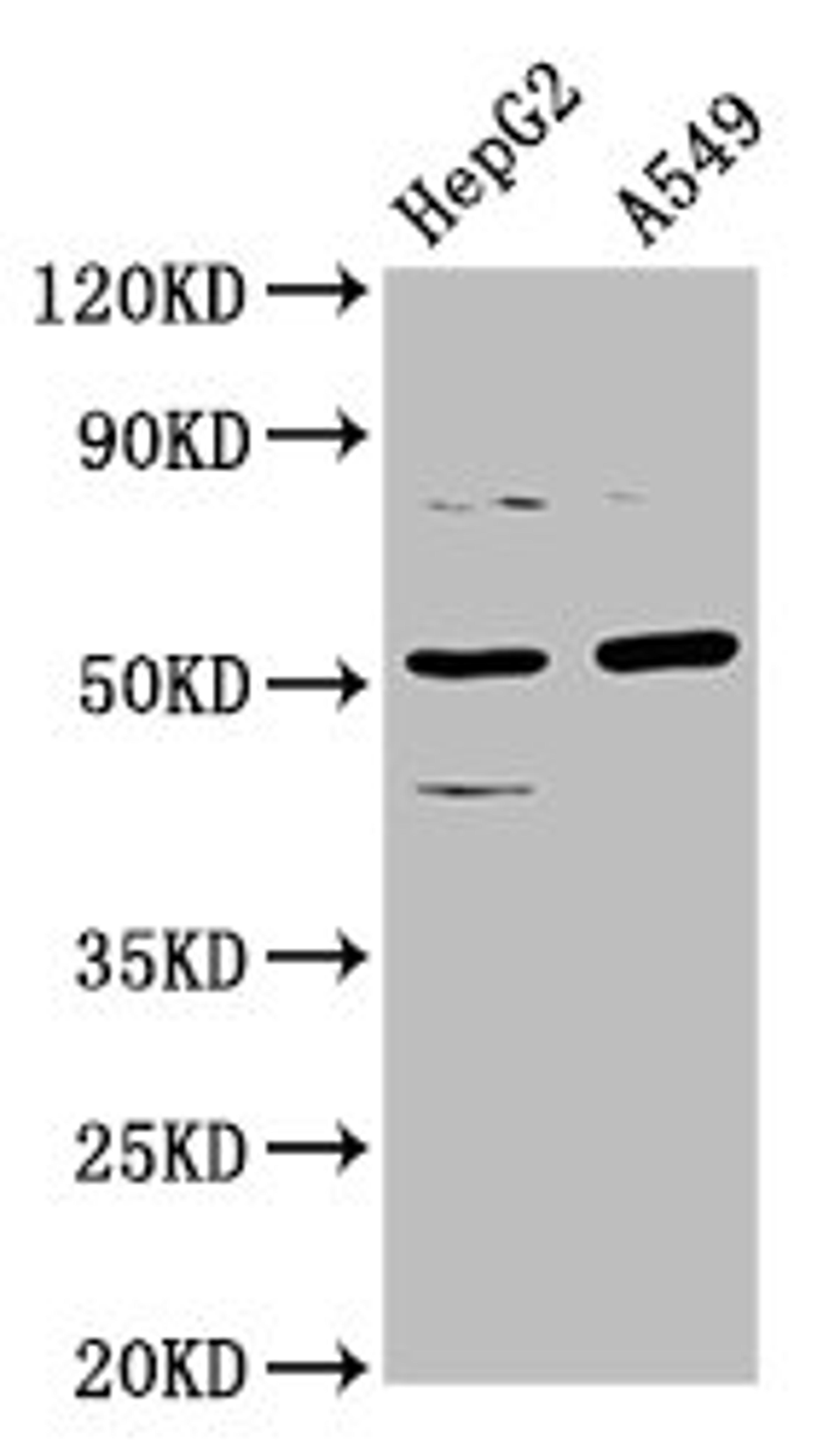 Western Blot. Positive WB detected in: HepG2 whole cell lysate, A549 whole cell lysate. All lanes: CPOX antibody at 5.7µg/ml. Secondary. Goat polyclonal to rabbit IgG at 1/50000 dilution. Predicted band size: 51, 31 kDa. Observed band size: 51 kDa