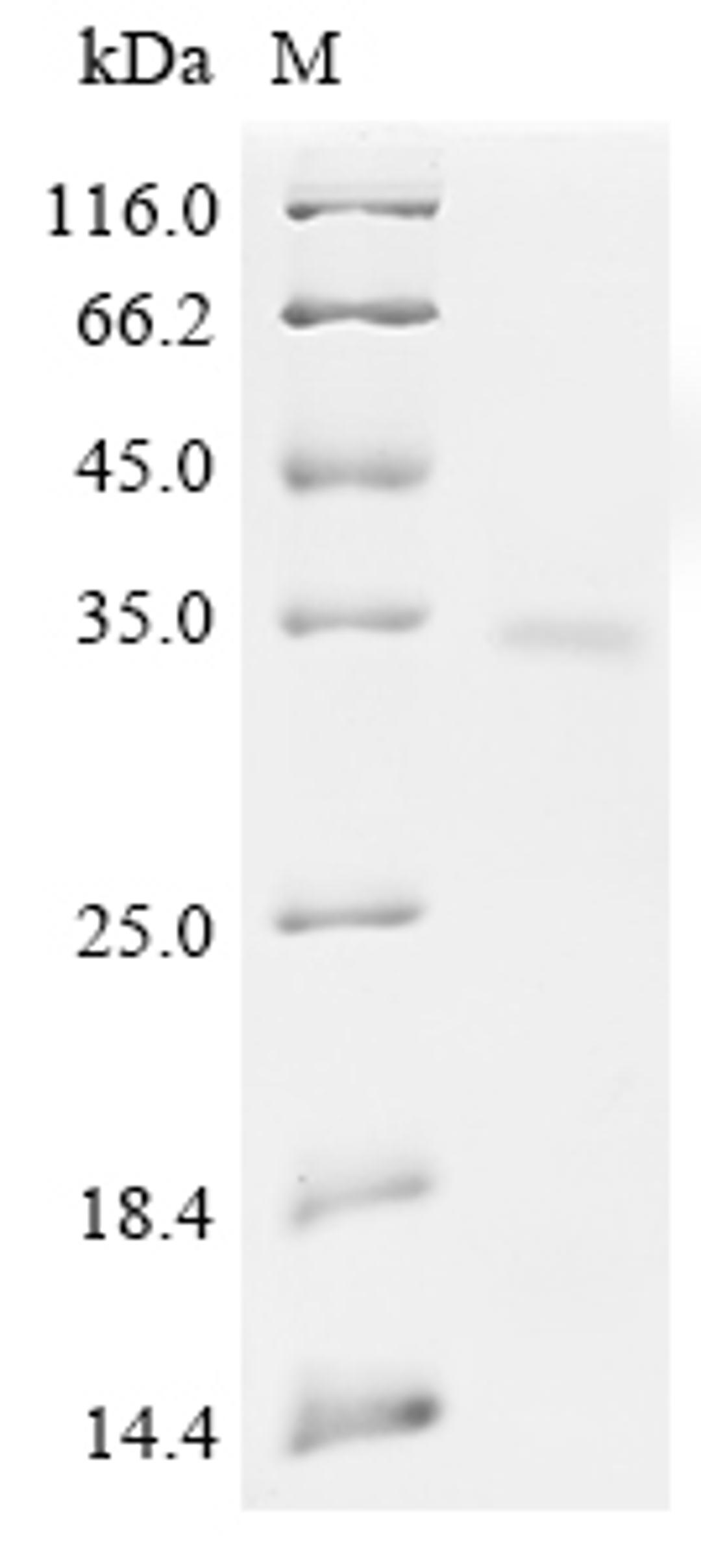 (Tris-Glycine gel) Discontinuous SDS-PAGE (reduced) with 5% enrichment gel and 15% separation gel.
