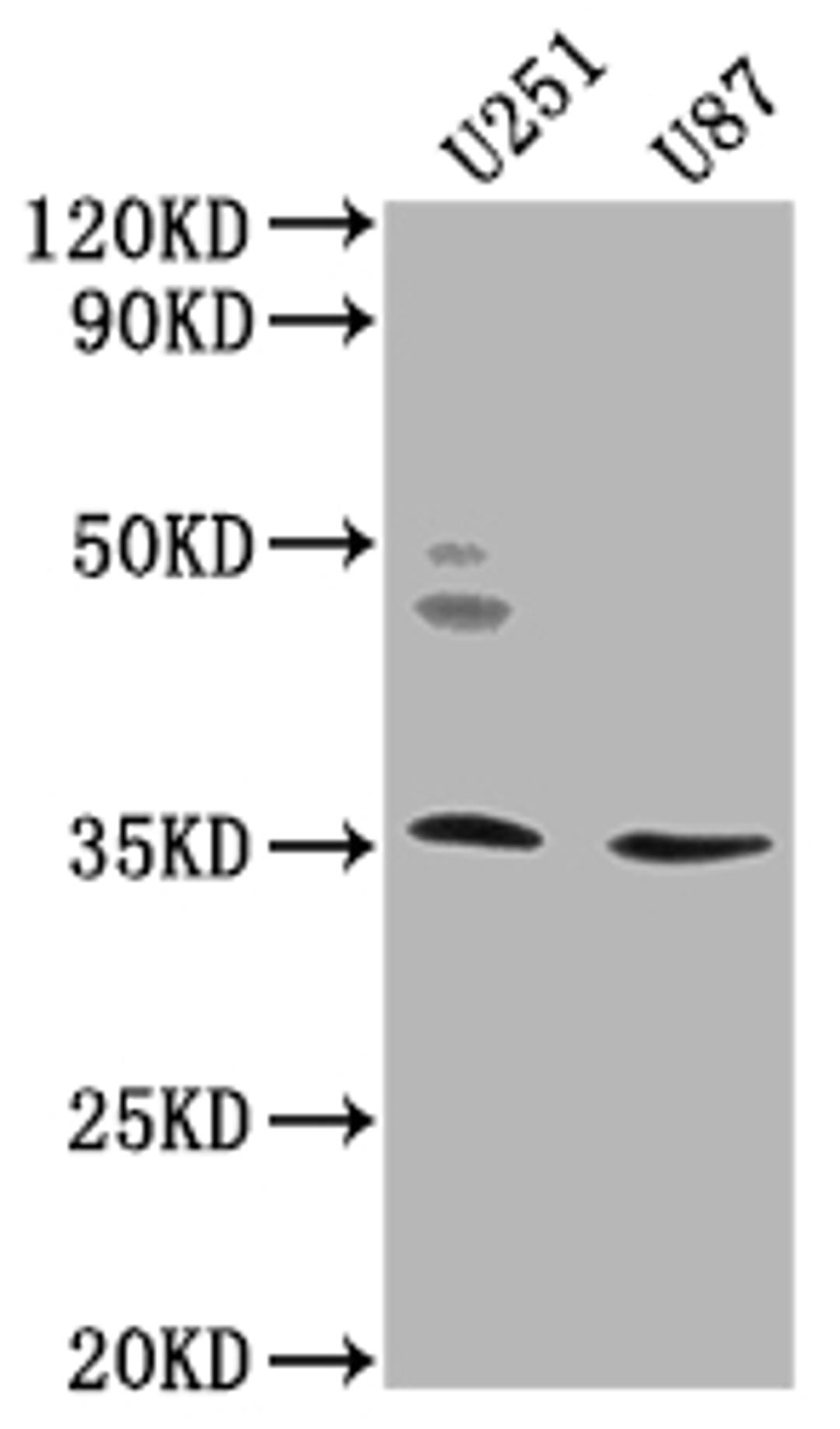 Western Blot. Positive WB detected in: U251 whole cell lysate, U87 whole cell lysate. All lanes: OR5K2 antibody at 1:2000. Secondary. Goat polyclonal to rabbit IgG at 1/50000 dilution. Predicted band size: 36 kDa. Observed band size: 36 kDa. 