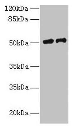 Western blot. All lanes: PLA2G7 antibody at 9µg/ml. Lane 1: RAW264.7 whole cell lysate. Lane 2: Mouse liver tissue. Secondary. Goat polyclonal to rabbit IgG at 1/10000 dilution. Predicted band size: 51 kDa. Observed band size: 51 kDa