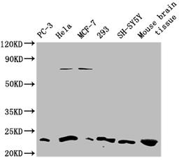 Western blot. Positive WB detected in: PC-3 whole cell lysate, Hela whole cell lysate, MCF-7 whole cell lysate, 293 whole cell lysate, SH-SY5Y whole cell lysate, Mouse brain tissue. All lanes: TMEM65 antibody at 1:1000. Secondary. Goat polyclonal to rabbit IgG at 1/50000 dilution. Predicted band size: 26 KDa. Observed band size: 20-25 KDa. Exposure time：5min. 