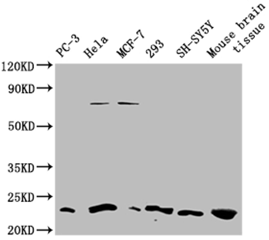 Western blot. Positive WB detected in: PC-3 whole cell lysate, Hela whole cell lysate, MCF-7 whole cell lysate, 293 whole cell lysate, SH-SY5Y whole cell lysate, Mouse brain tissue. All lanes: TMEM65 antibody at 1:1000. Secondary. Goat polyclonal to rabbit IgG at 1/50000 dilution. Predicted band size: 26 KDa. Observed band size: 20-25 KDa. Exposure time:5min.
