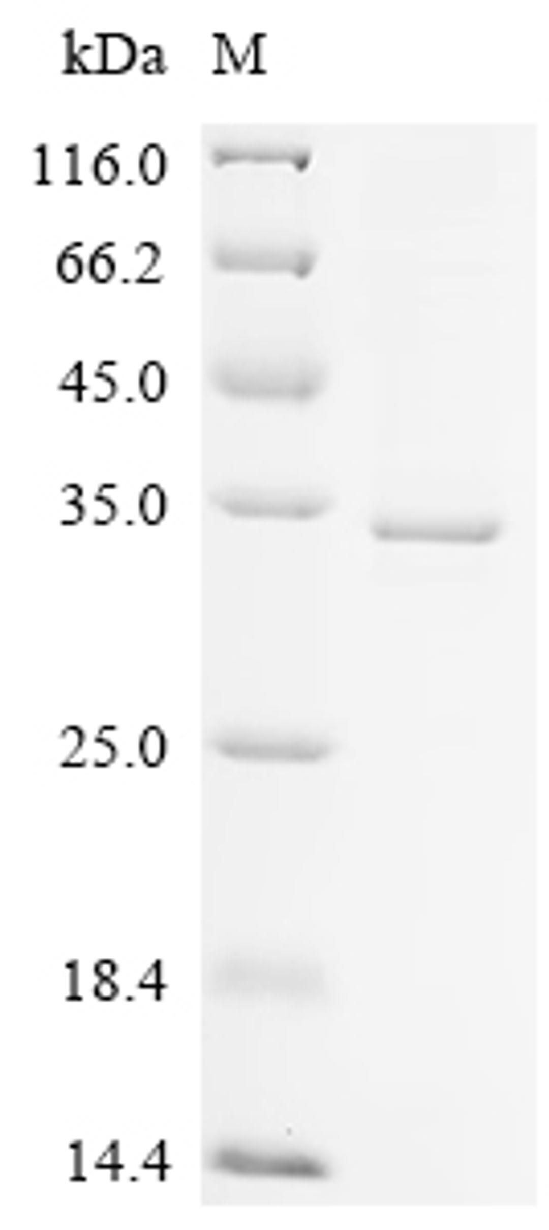 (Tris-Glycine gel) Discontinuous SDS-PAGE (reduced) with 5% enrichment gel and 15% separation gel.