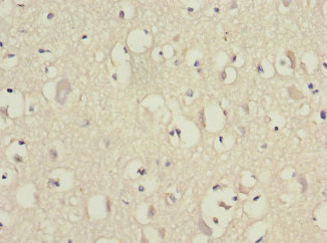 Immunohistochemistry of paraffin-embedded human brain tissue using CSB-PA007535ESR2HU at dilution of 1:100