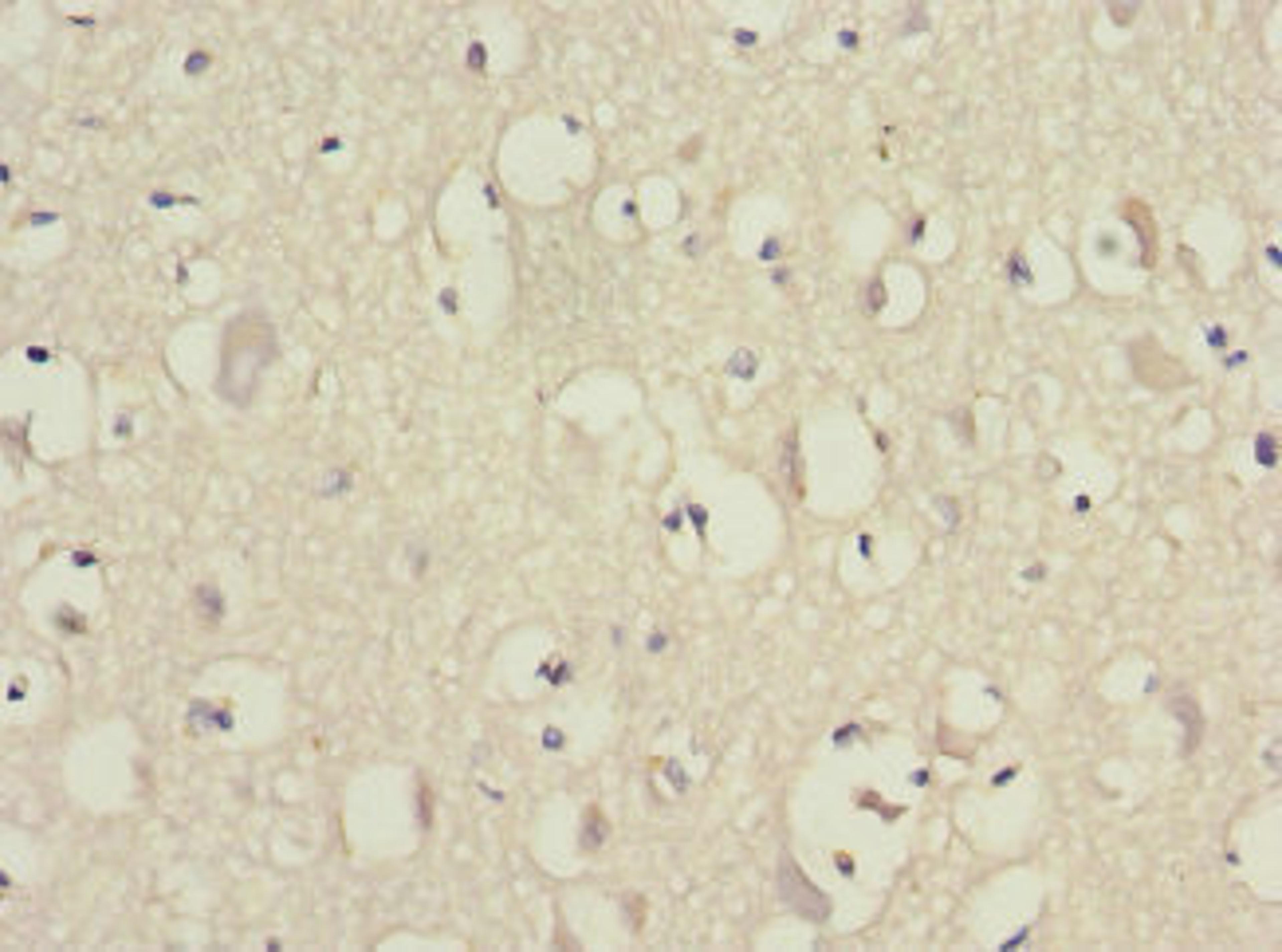 Immunohistochemistry of paraffin-embedded human brain tissue using CSB-PA007535ESR2HU at dilution of 1:100