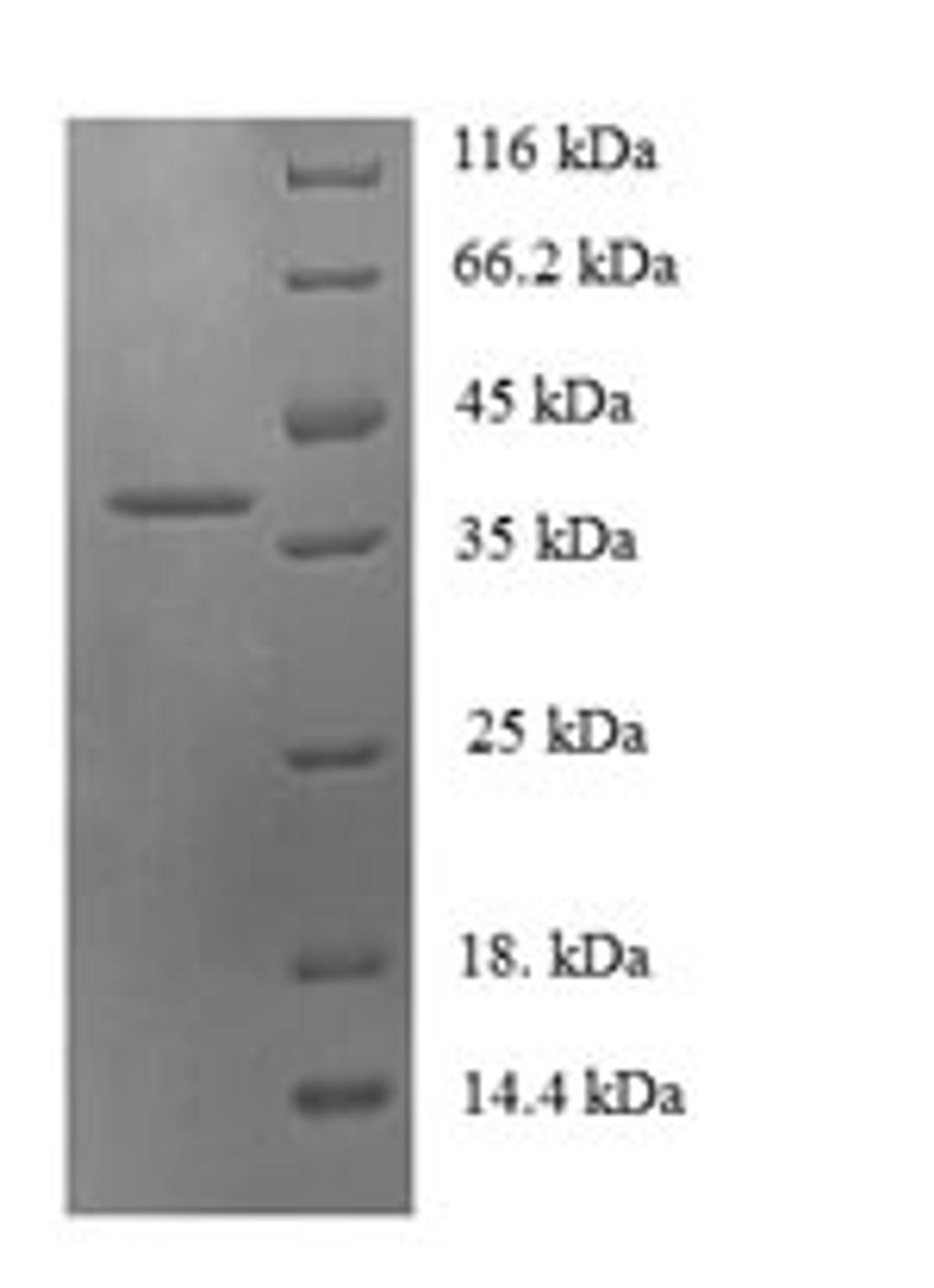 (Tris-Glycine gel) Discontinuous SDS-PAGE (reduced) with 5% enrichment gel and 15% separation gel.