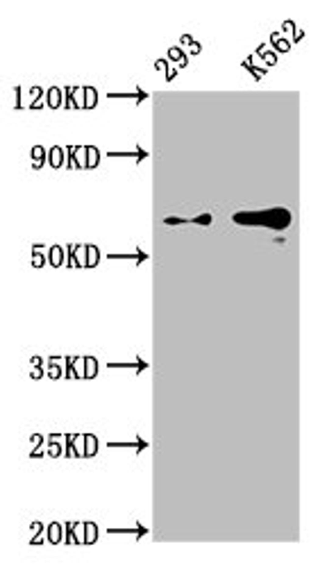 Western Blot. Positive WB detected in: 293 whole cell lysate, K562 whole cell lysate. All lanes: GPC3 antibody at 0.9μg/ml. Secondary. Goat polyclonal to rabbit IgG at 1/50000 dilution. Predicted band size: 66, 60, 69 KDa. Observed band size: 66 KDa. 
